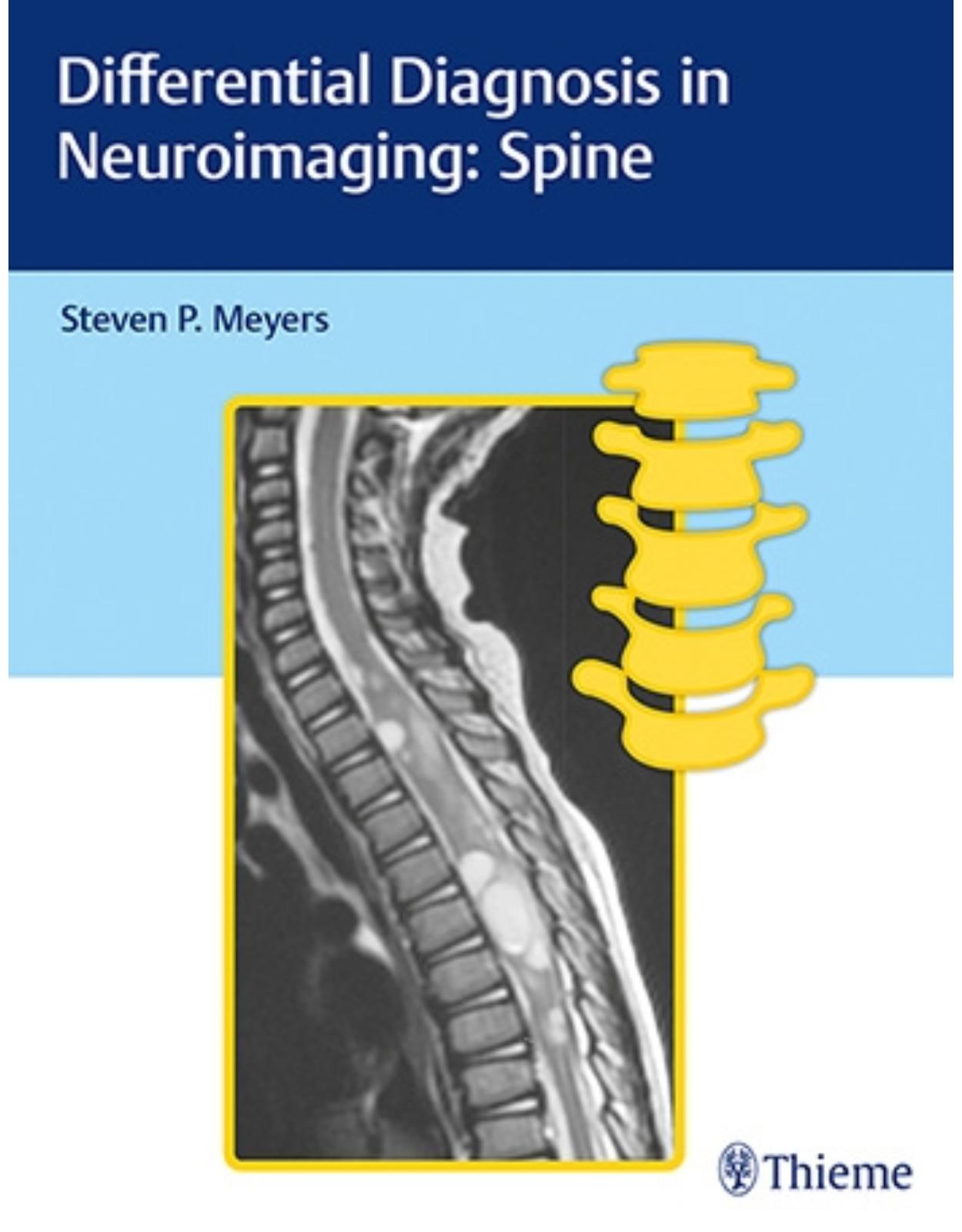  Differential Diagnosis in Neuroimaging