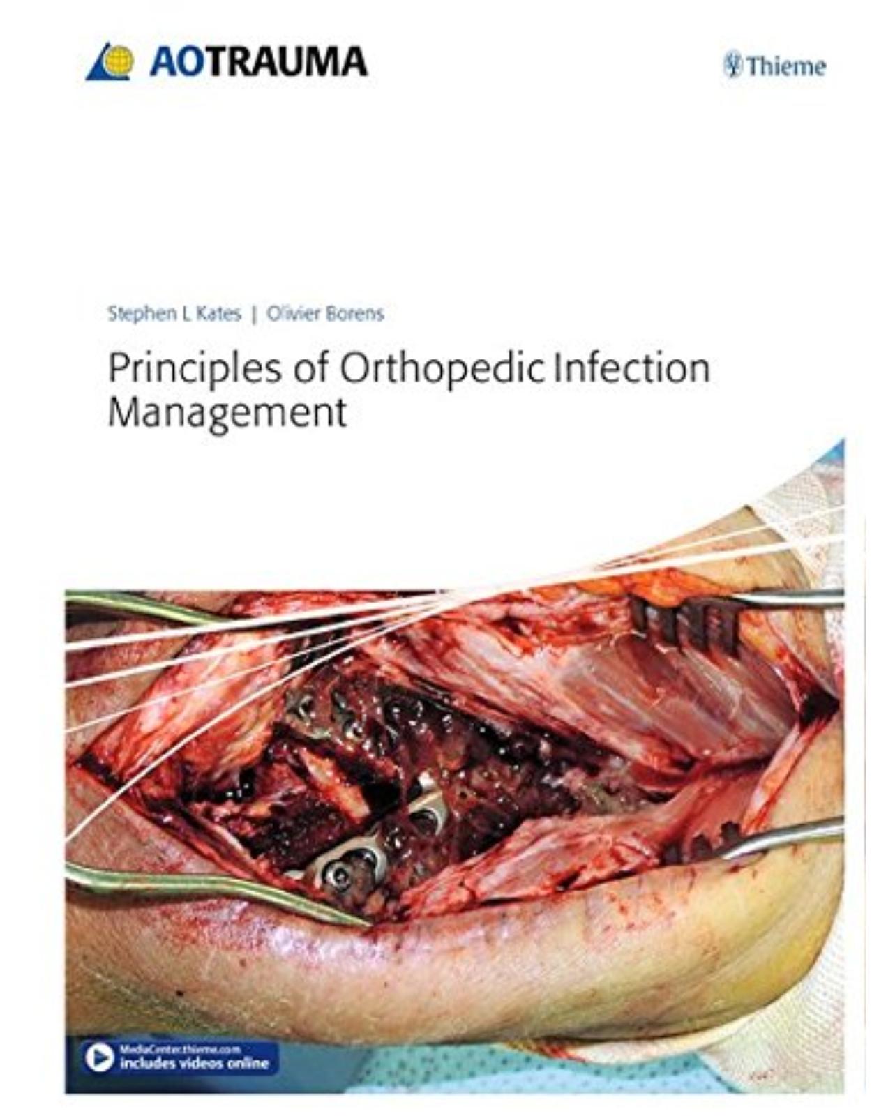  Principles of Orthopedic Infection Management