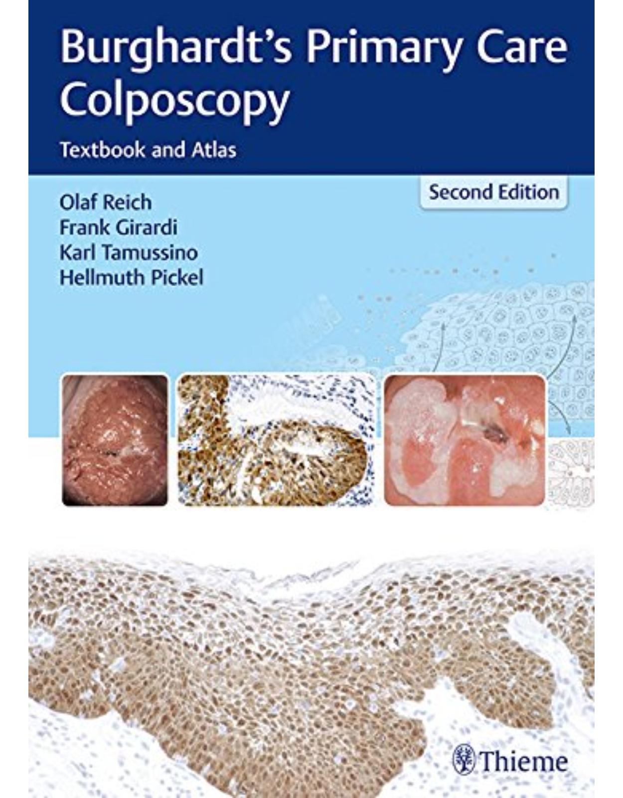 Burghardt’s Primary Care Colposcopy