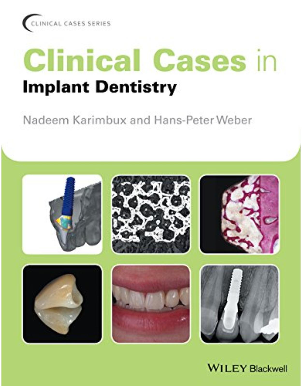 Clinical Cases in Implant Dentistry