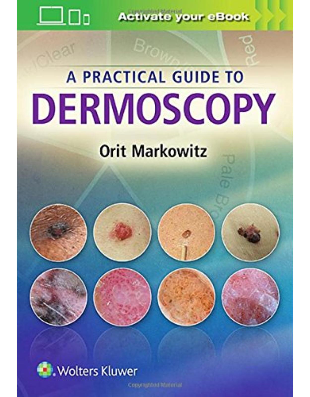 A Practical Guide to Dermoscopy
