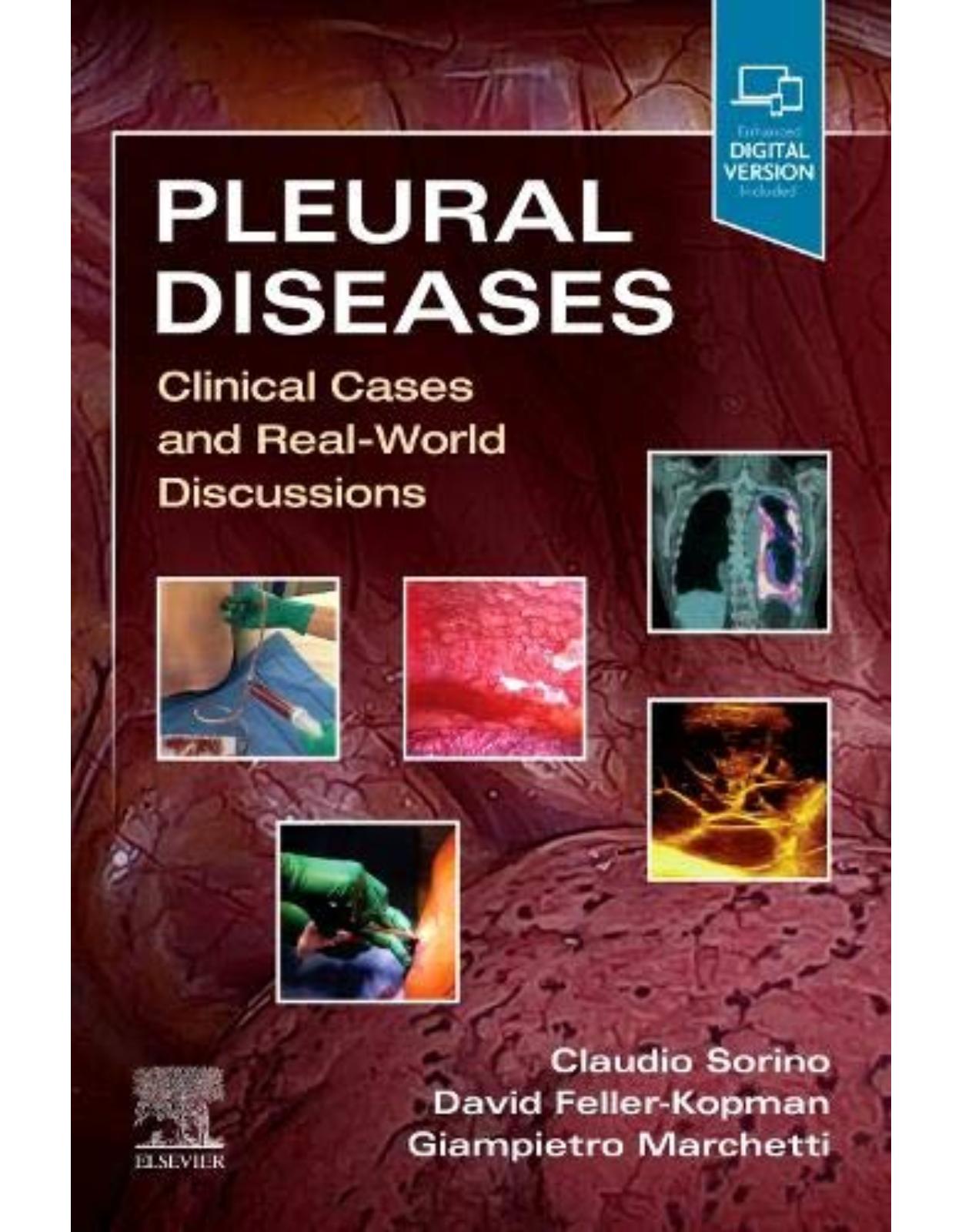 Pleural Diseases: Clinical Cases and Real-World Discussions