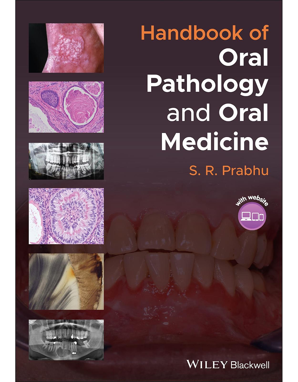 Handbook of Oral Pathology and Oral Medicine