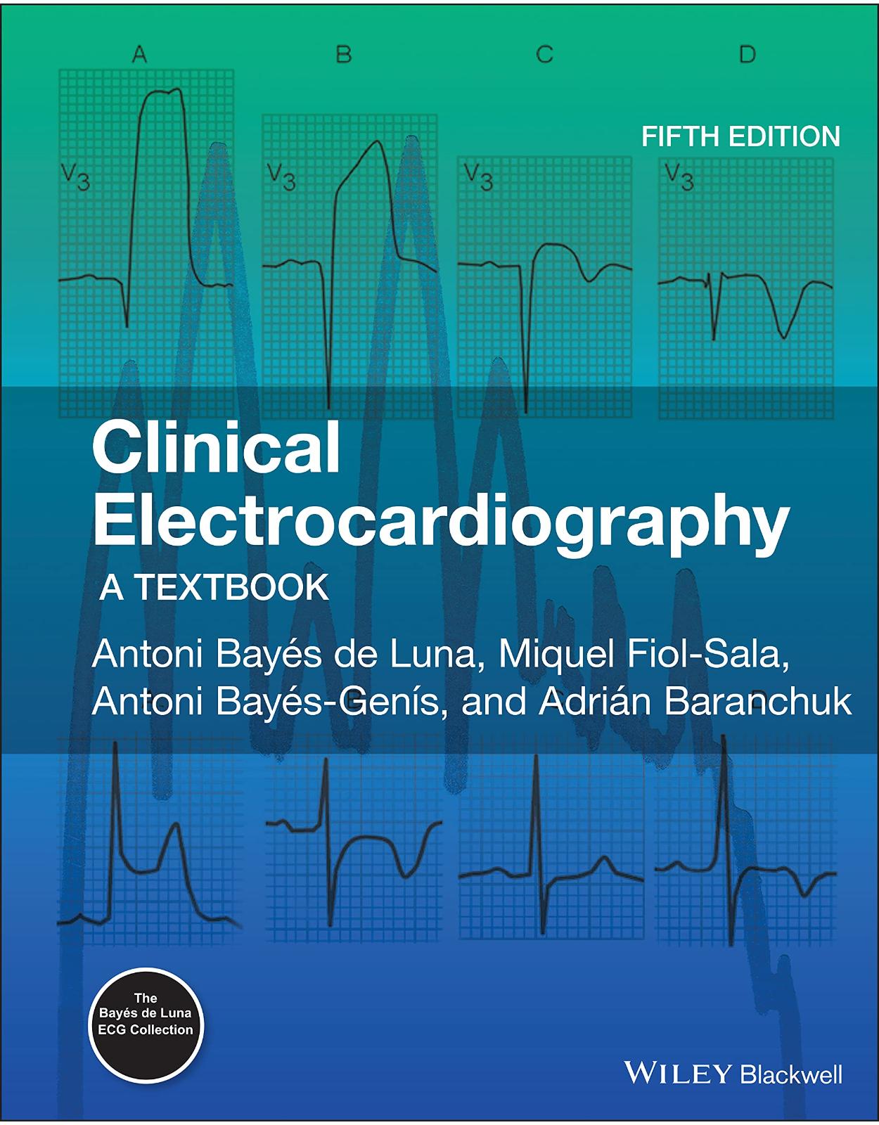 Clinical Electrocardiography: A Textbook