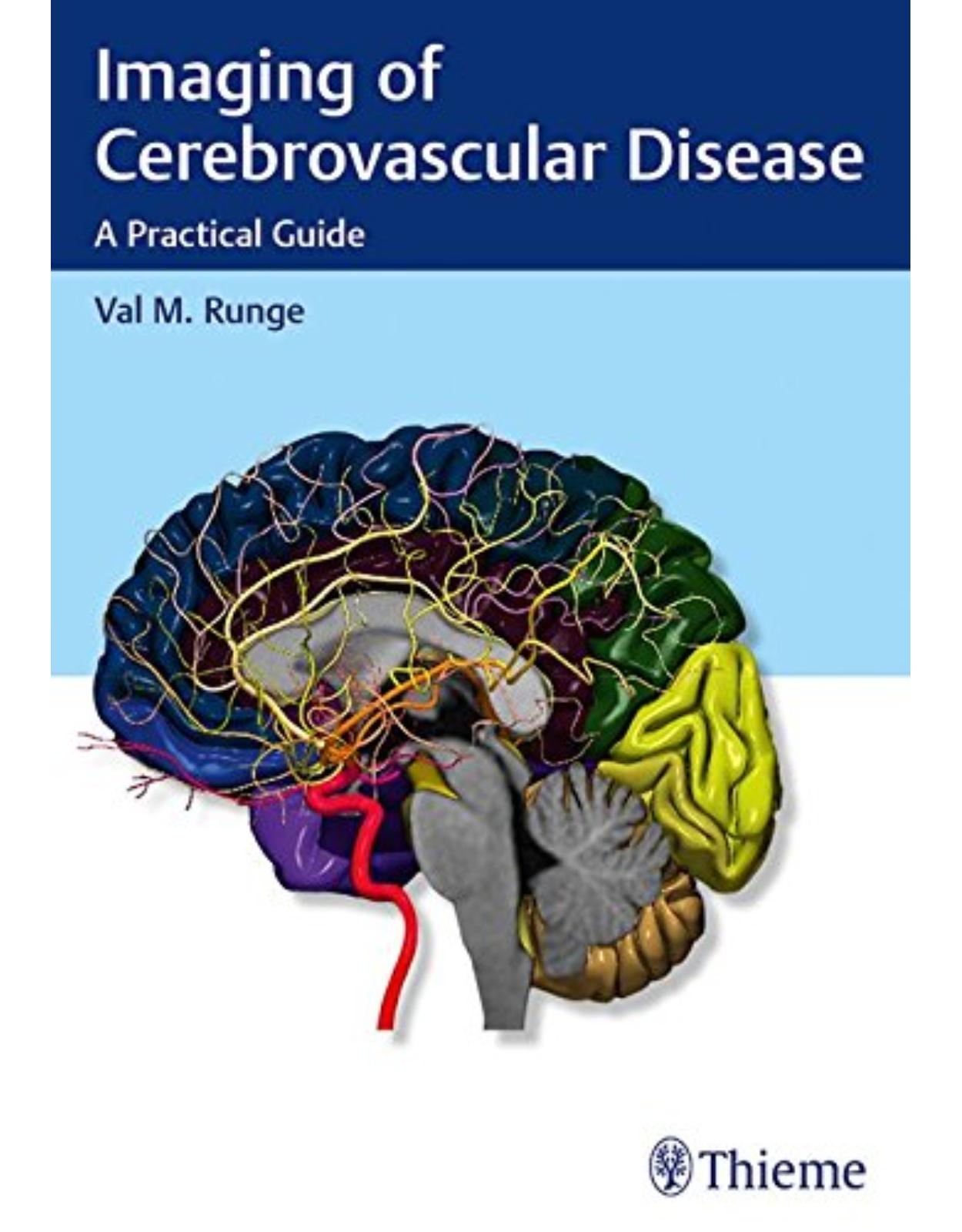  Imaging of Cerebrovascular Disease
