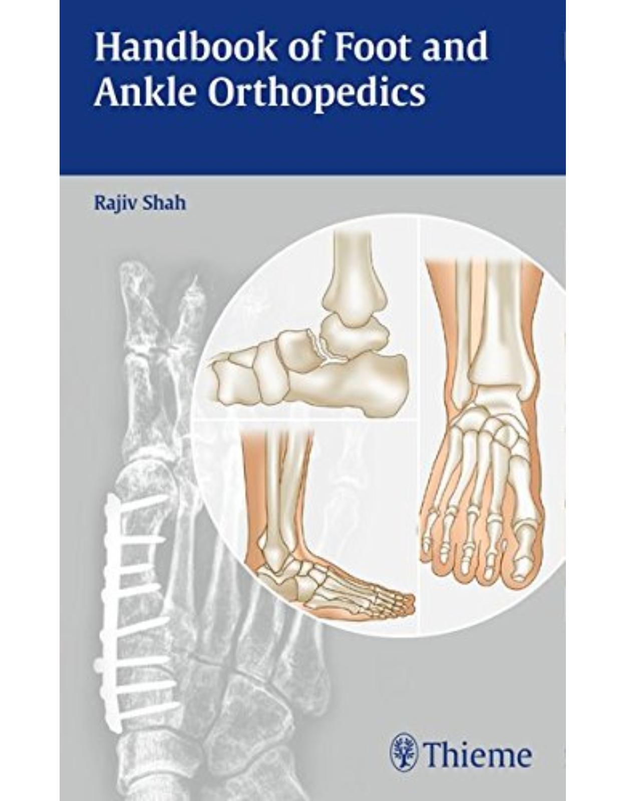 Handbook of Foot and Ankle Orthopedics