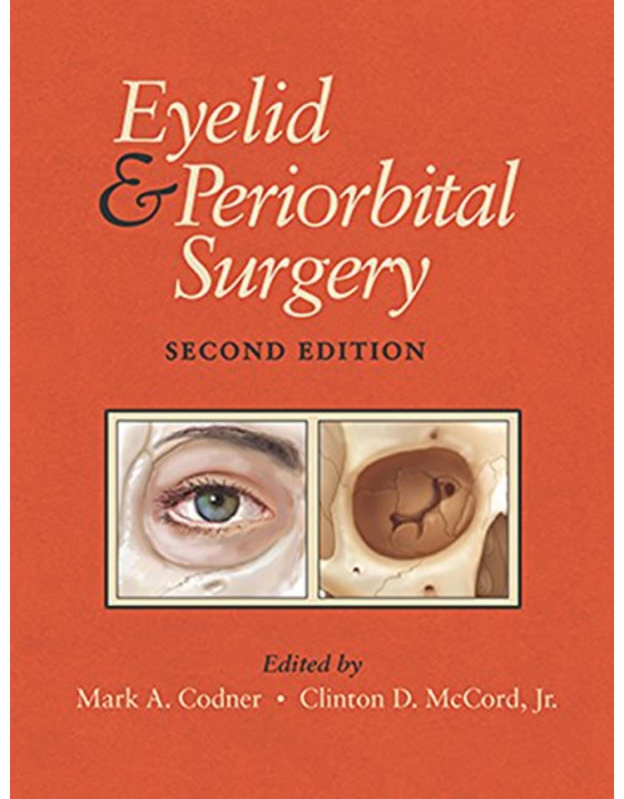  Eyelid and Periorbital Surgery