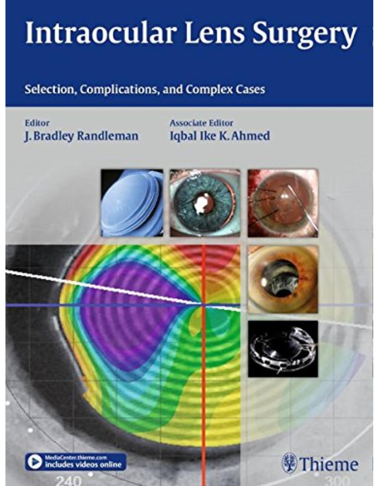  Intraocular Lens Surgery