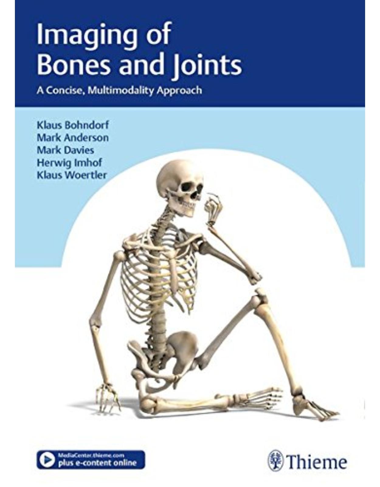  Imaging of Bones and Joints