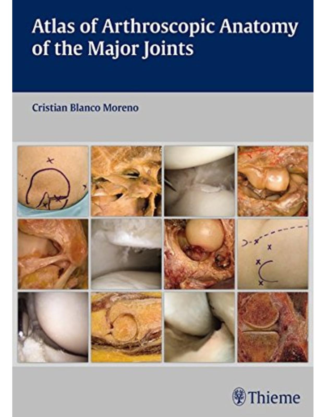 Atlas of Arthroscopic Anatomy of Major Joints
