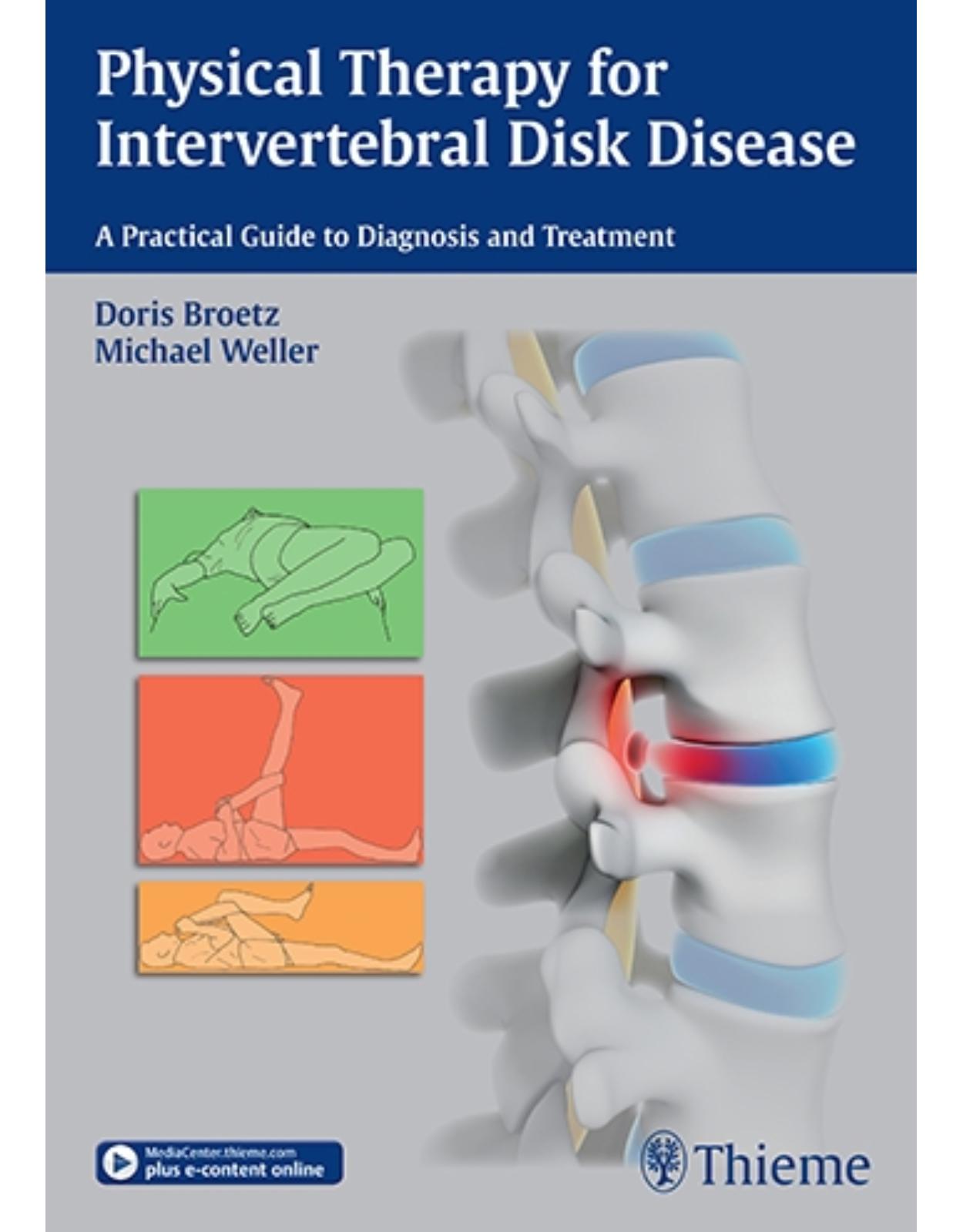 Physical Therapy for Intervertebral Disk Disease: A Practical Guide to Diagnosis and Treatment