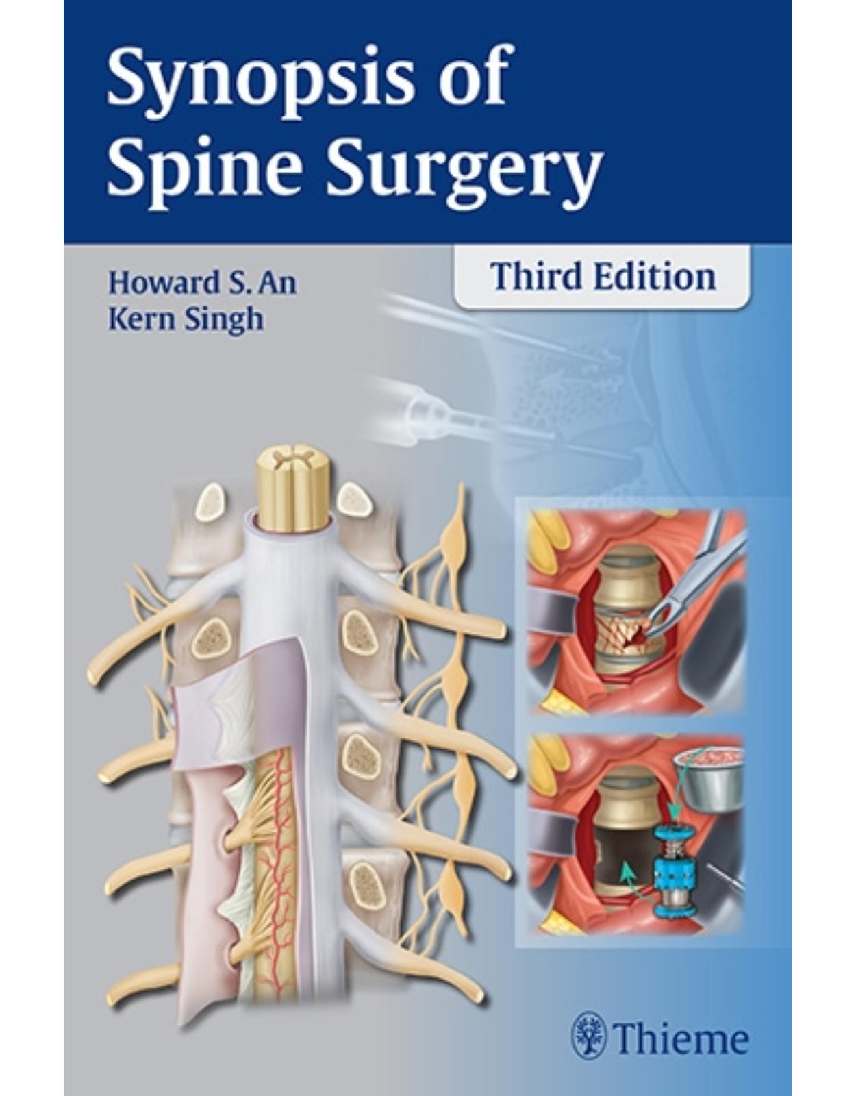 Synopsis of Spine Surgery