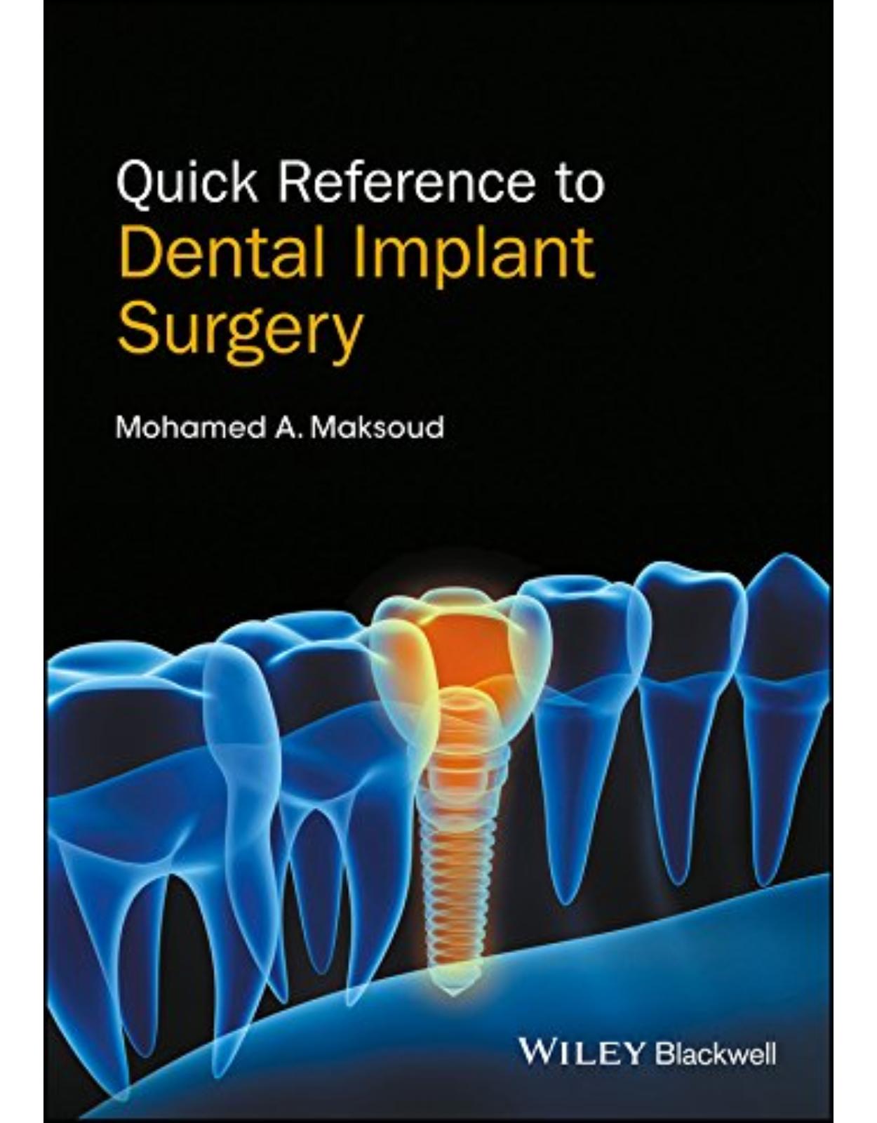 Quick Reference to Dental Implant Surgery