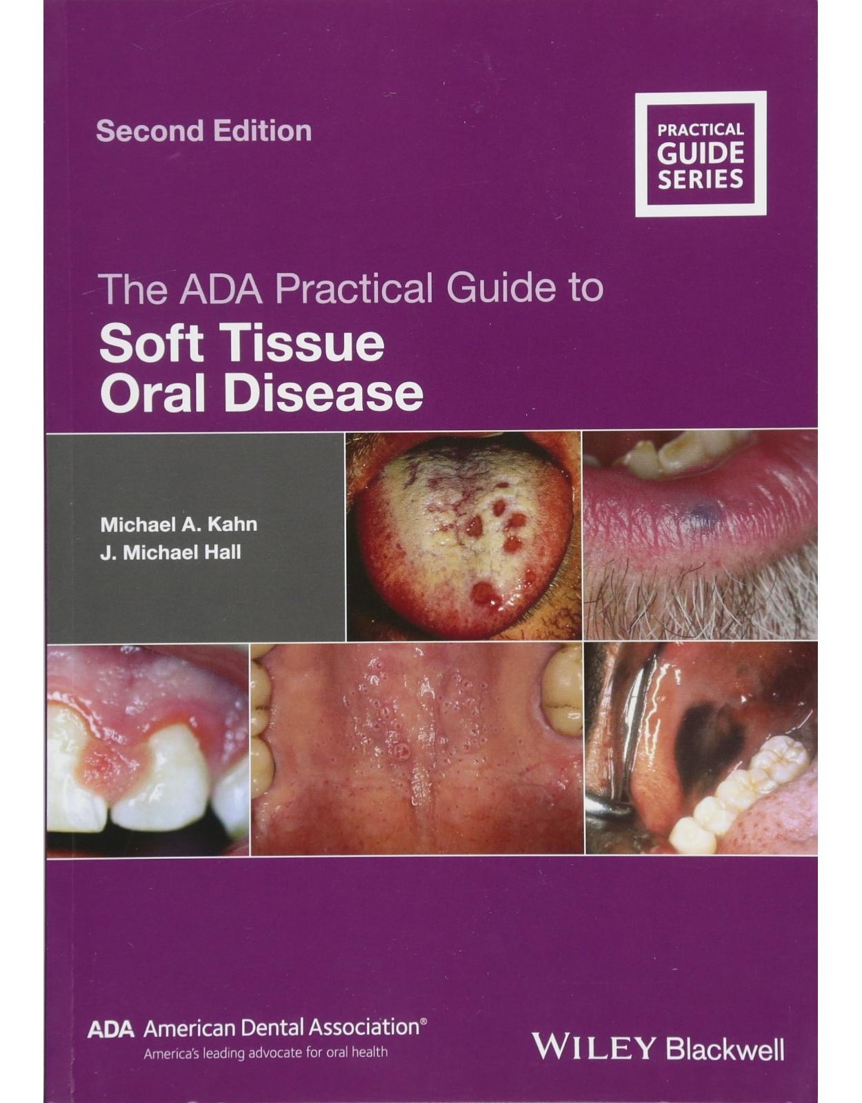 The ADA Practical Guide to Soft Tissue Oral Disease