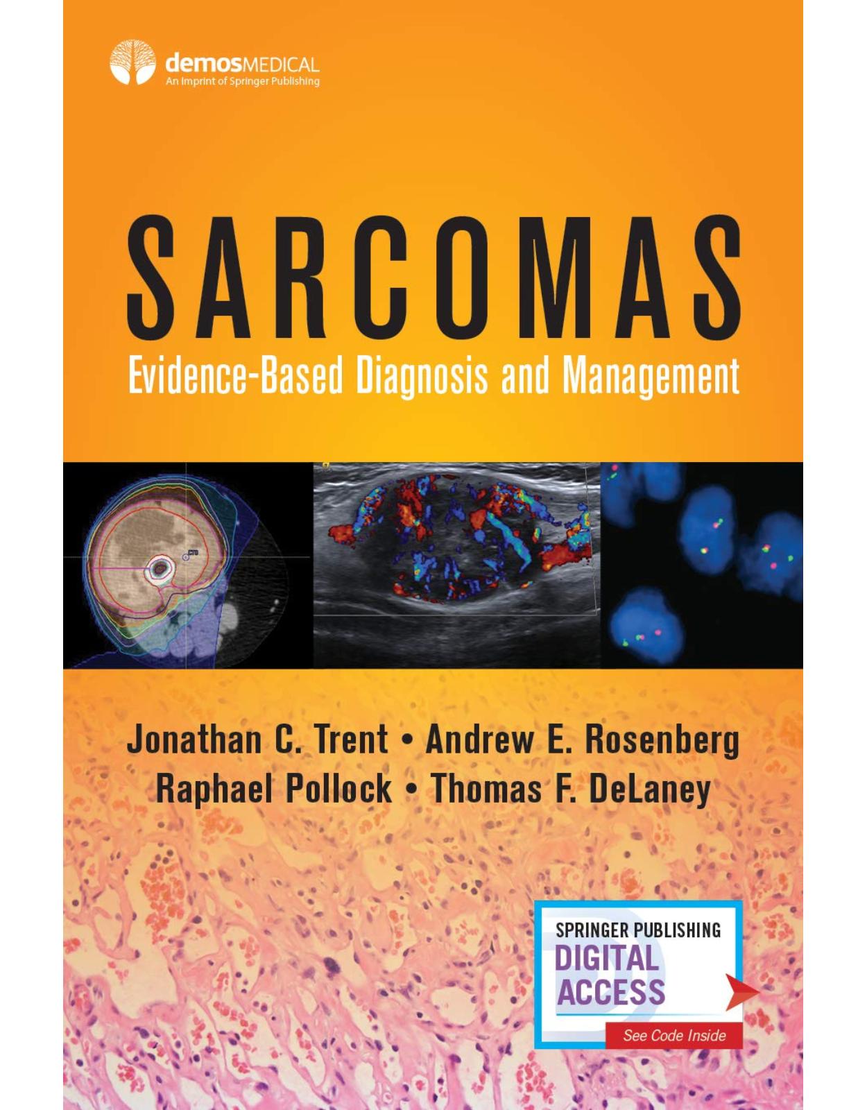 Sarcomas: Evidence-based Diagnosis and Management