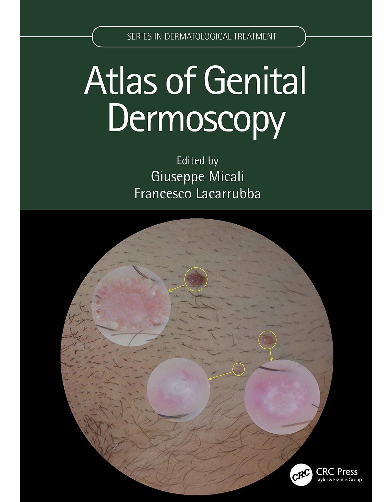 Atlas of Genital Dermoscopy