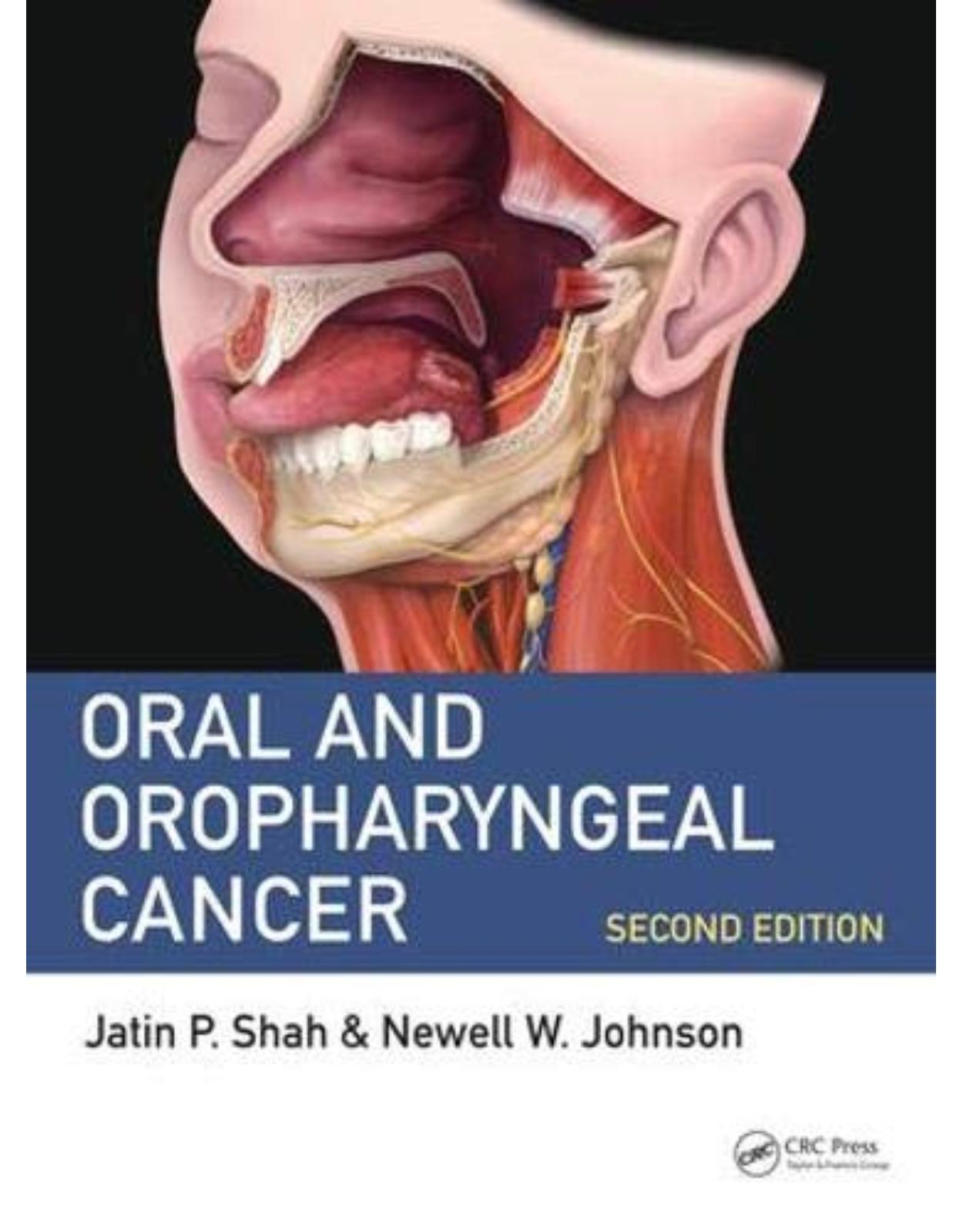 Oral and Oropharyngeal Cancer