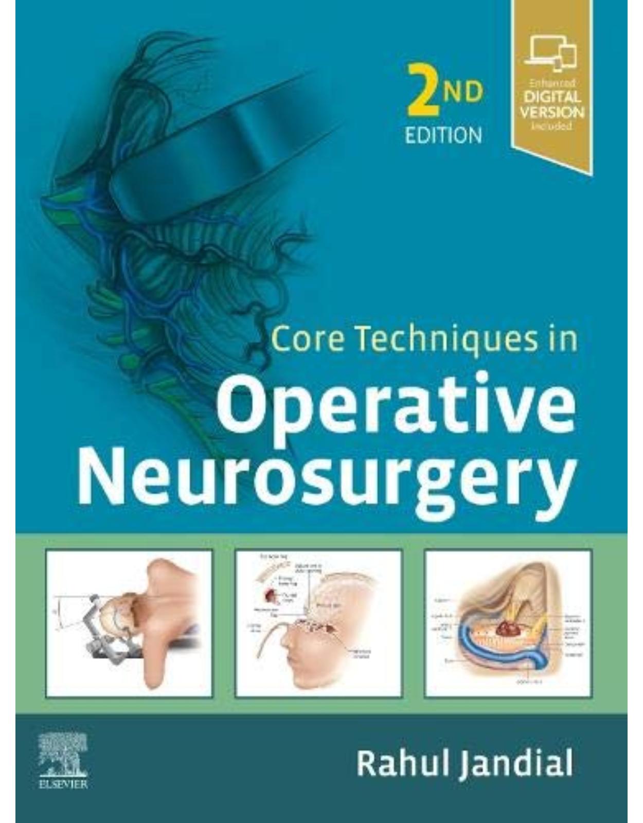 Core Techniques in Operative Neurosurgery, 2nd Edition