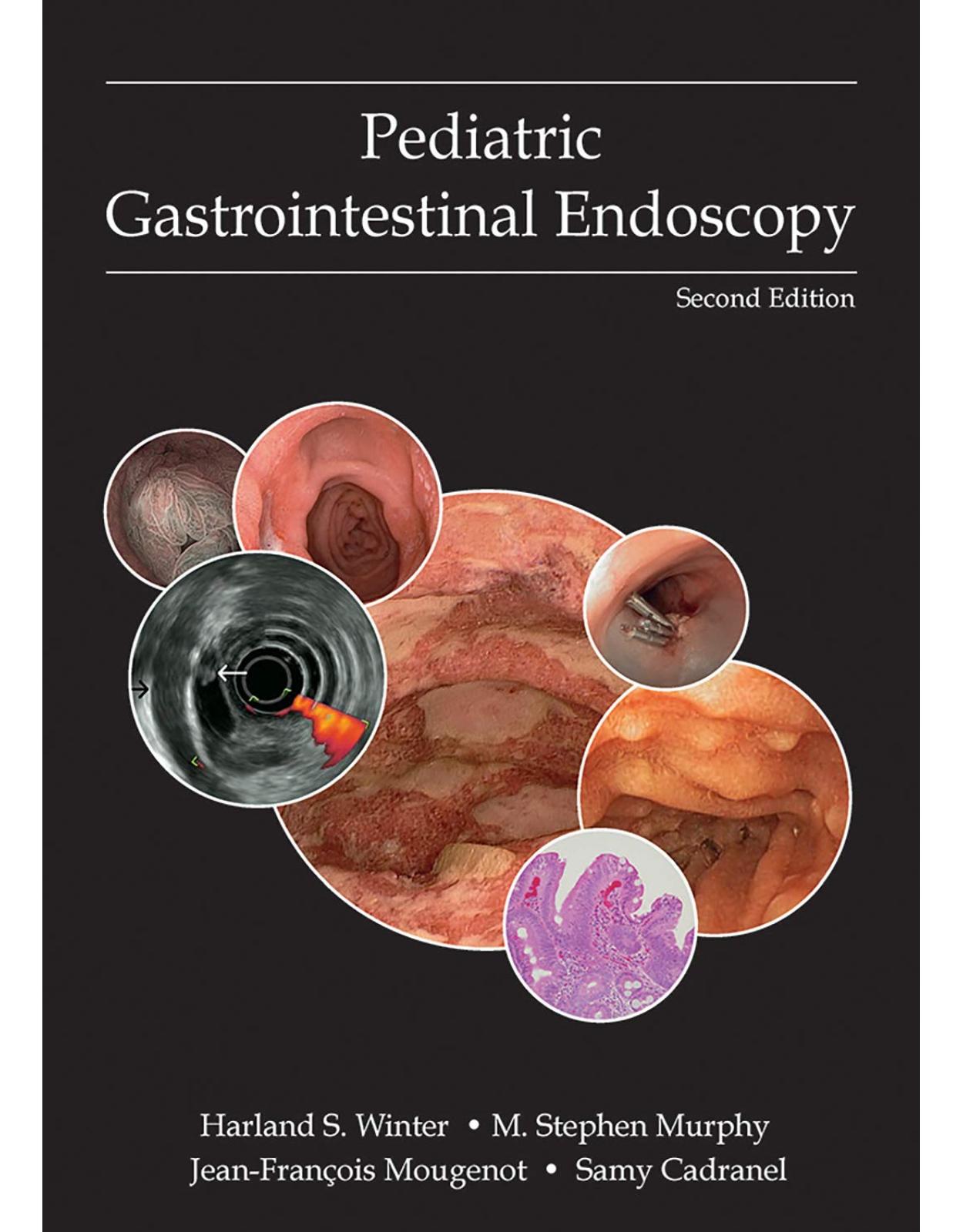 Pediatric Gastrointestinal Endoscopy