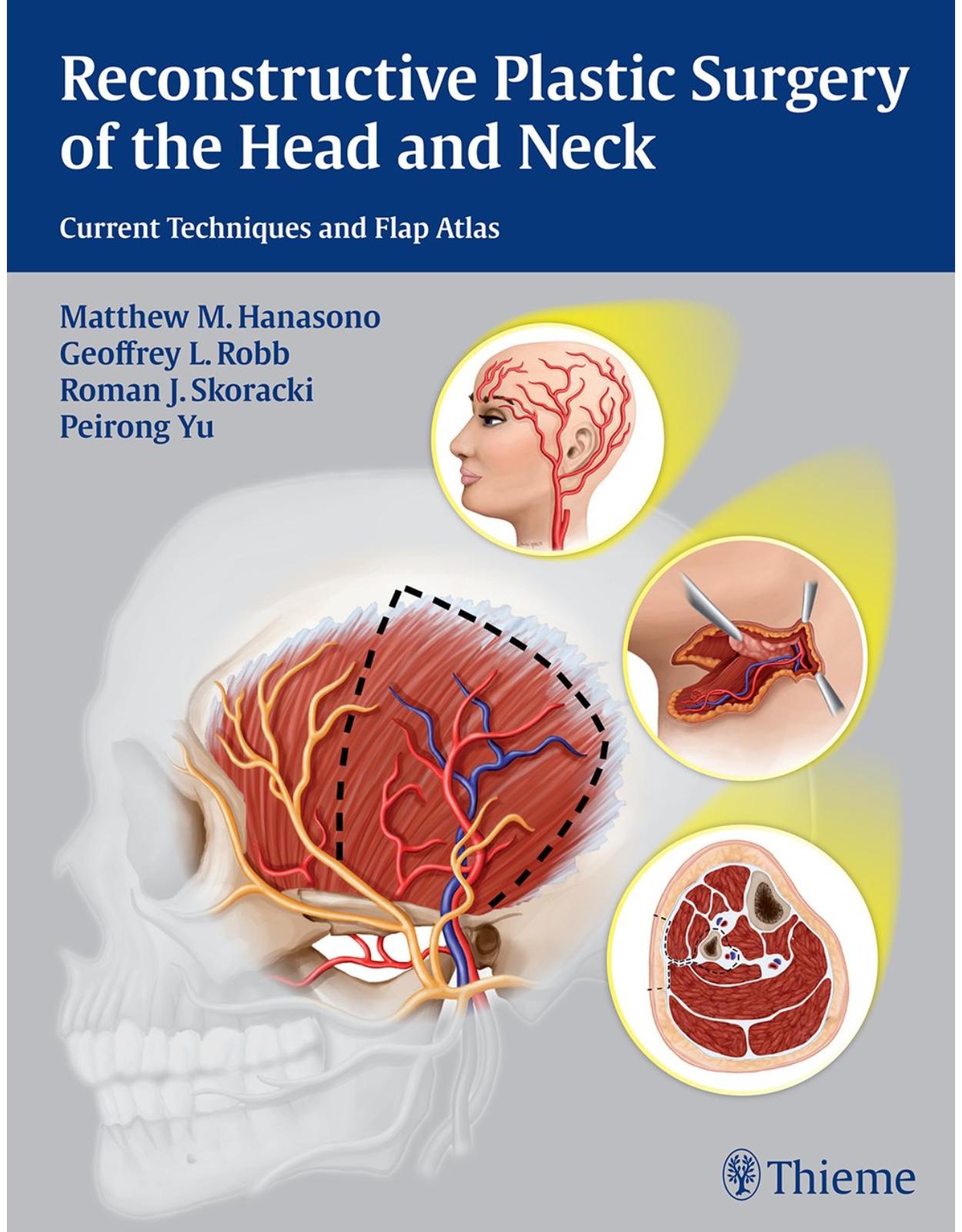 Reconstructive Plastic Surgery of the Head and Neck: Current Techniques and Flap Atlas