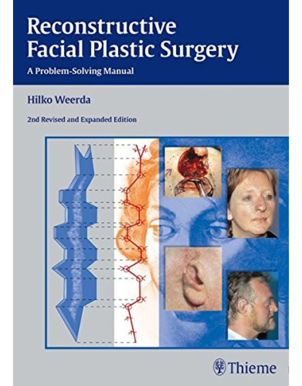 Reconstructive Facial Plastic Surgery
