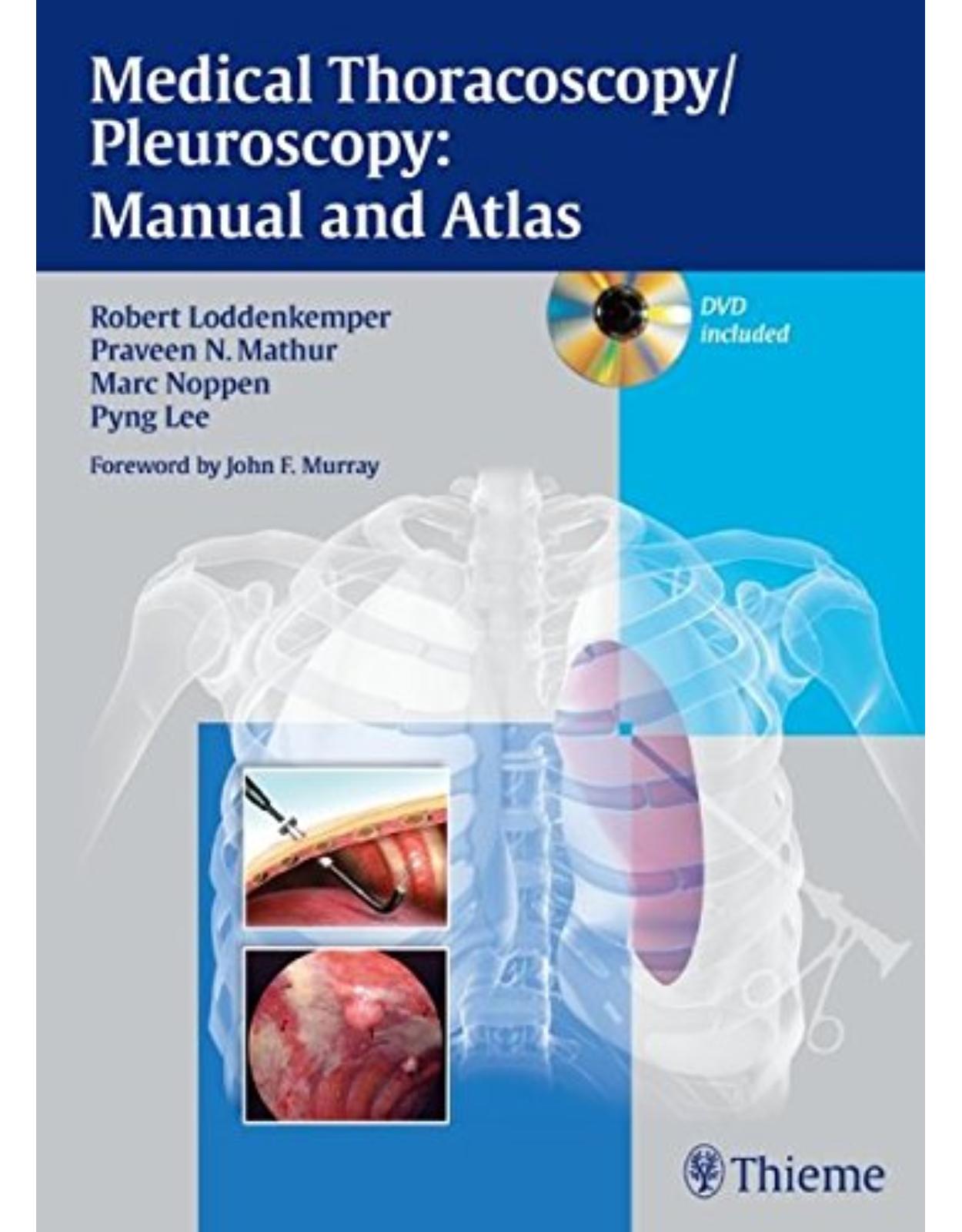 Medical Thoracoscopy / Pleuroscopy, with DVD