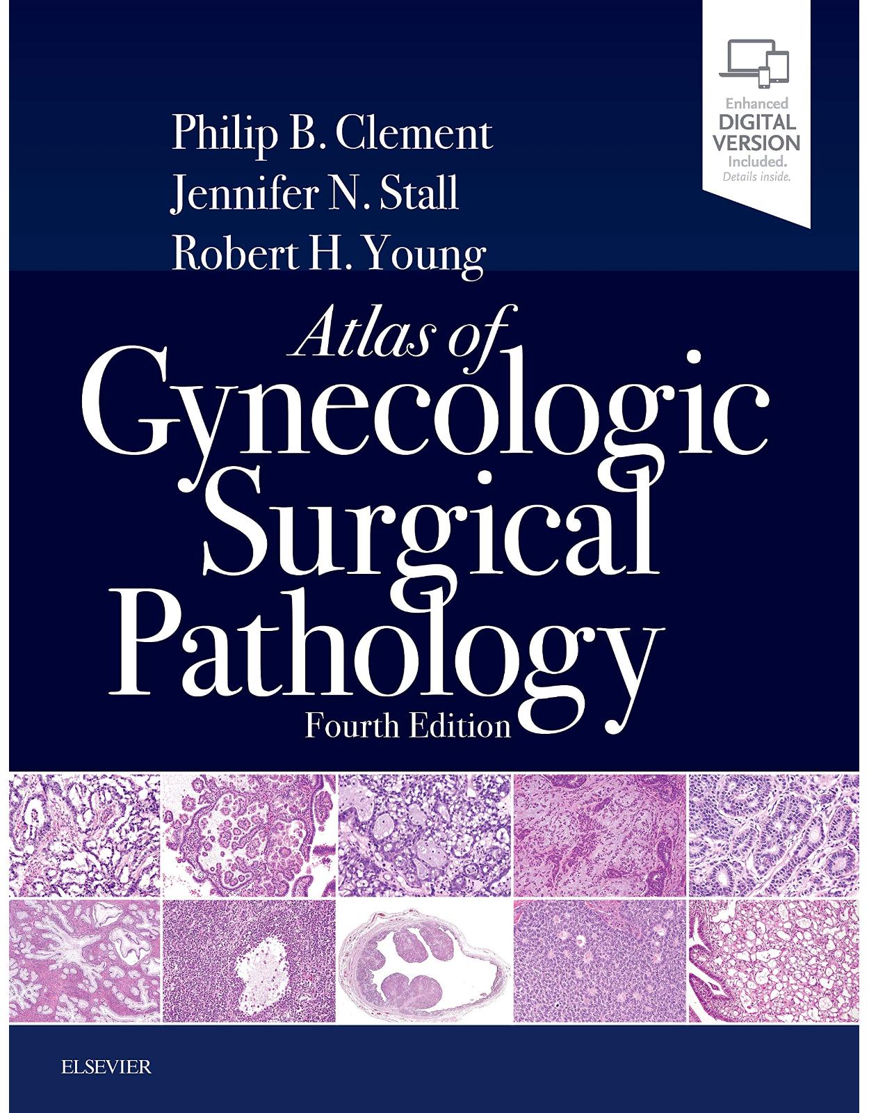 Atlas of Gynecologic Surgical Pathology, 4th Edition