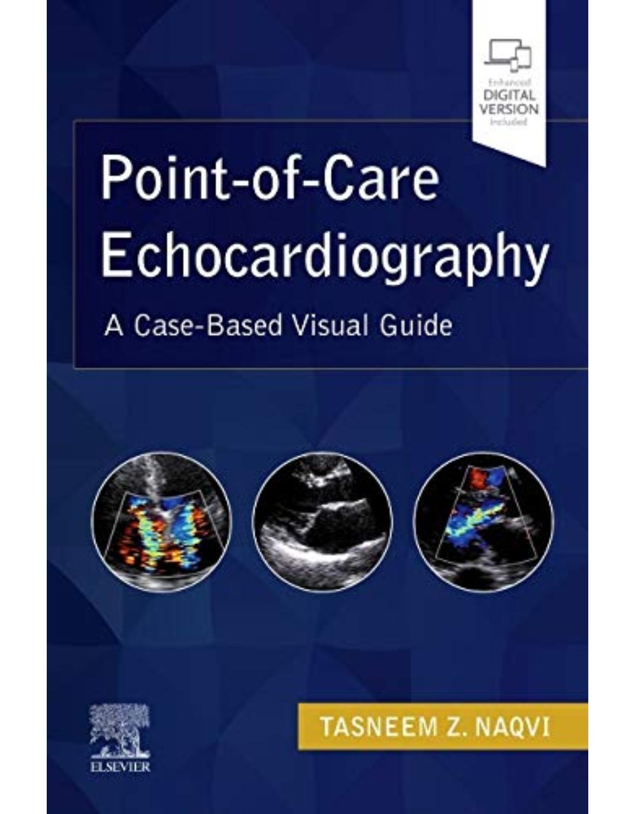 Point-of-Care Echocardiography: A Clinical Case-Based Visual Guide 