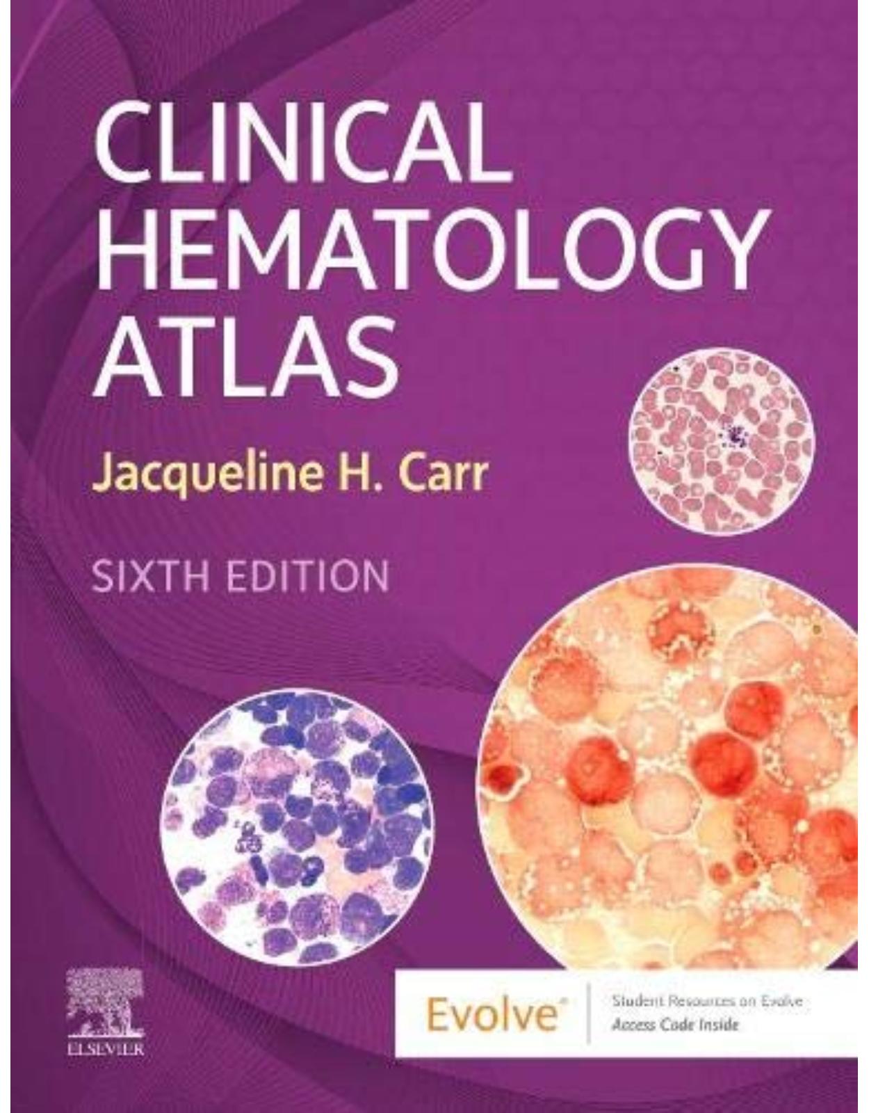 Clinical Hematology Atlas