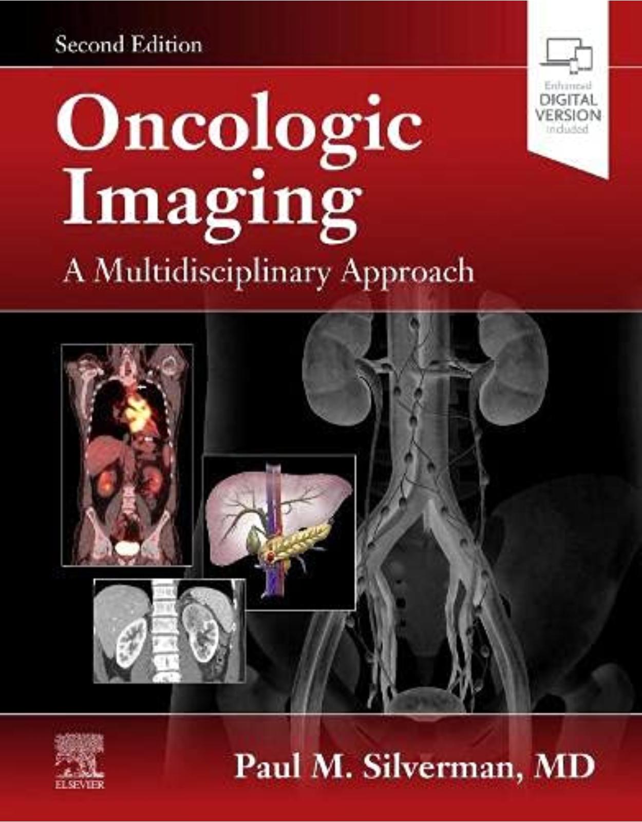 Oncologic Imaging: A Multidisciplinary Approach, 2nd Edition