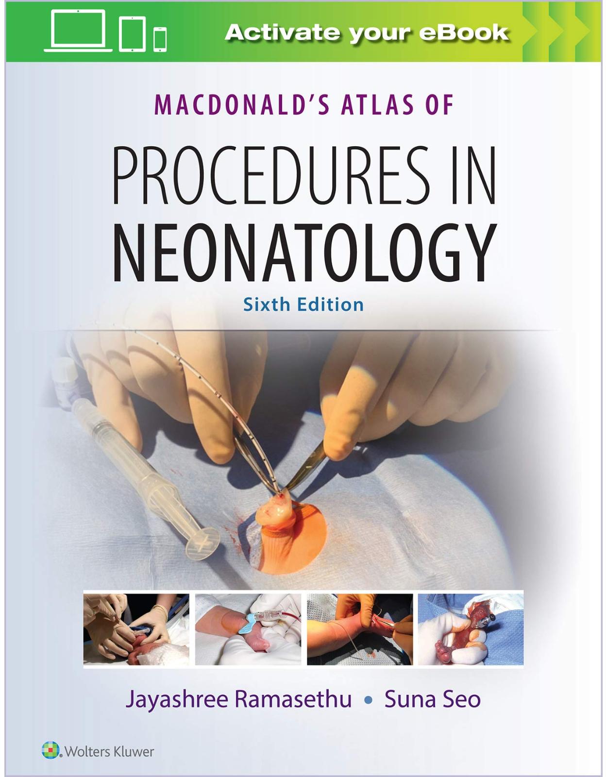 MacDonald’s Atlas of Procedures in Neonatology