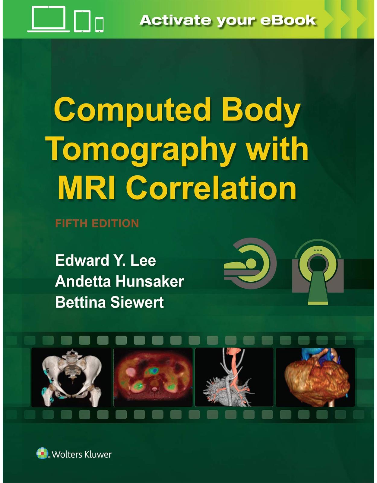 Computed Body Tomography with MRI Correlation. Fifth edition