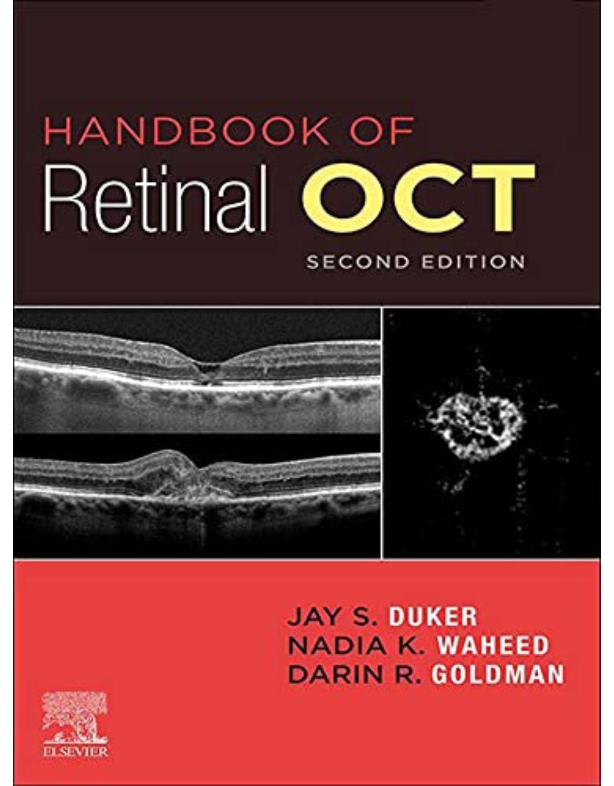 Handbook of Retinal OCT: Optical Coherence Tomography, 2nd Edition