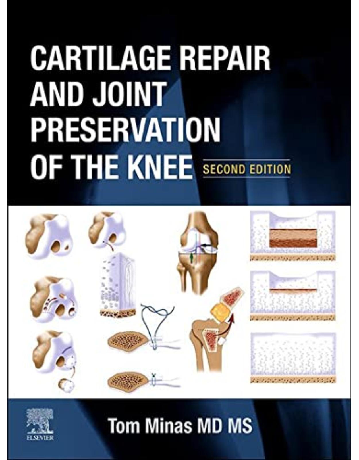 Cartilage Repair and Joint Preservation of the Knee, 2nd Edition