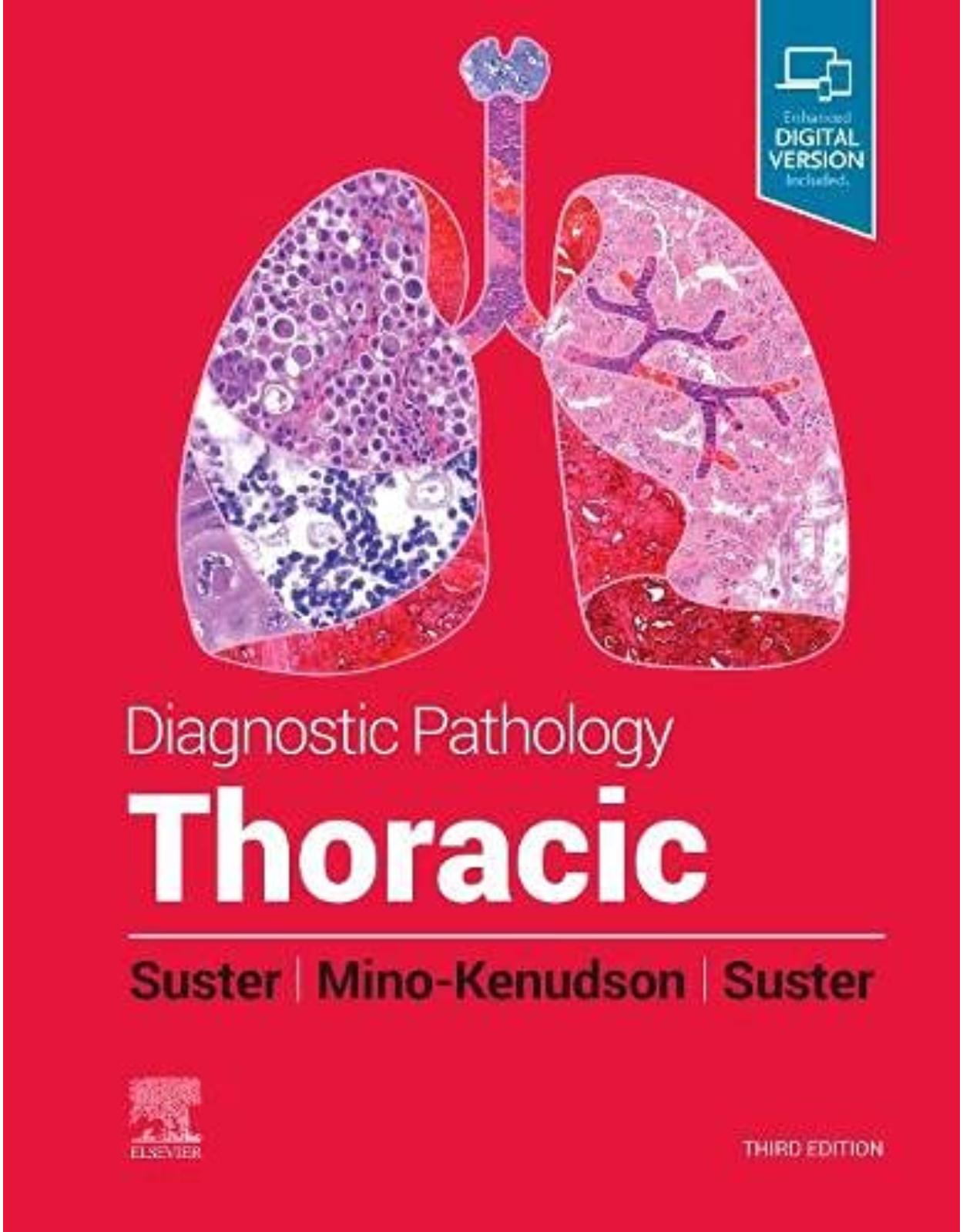 Diagnostic Pathology: Thoracic, 3rd Edition