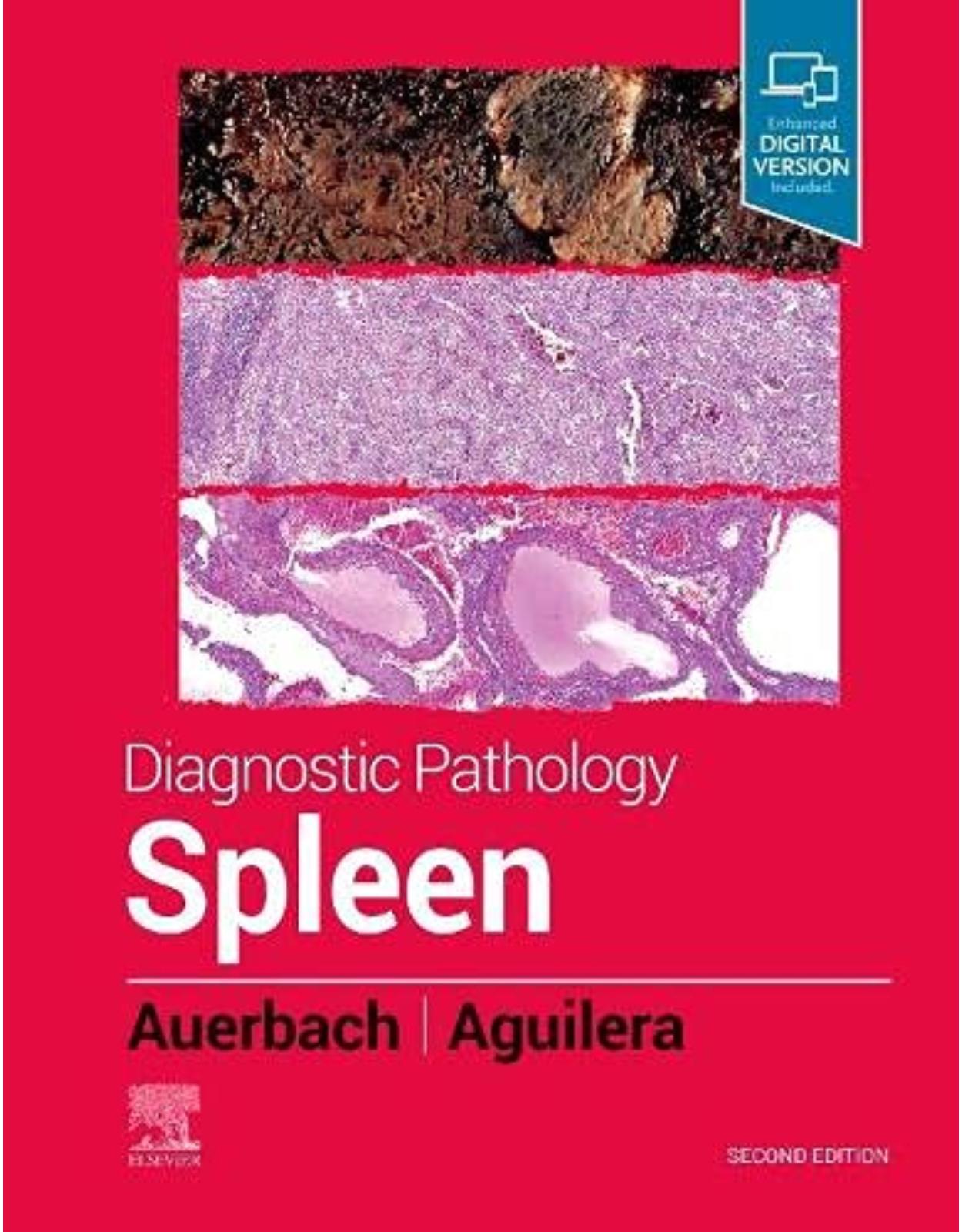 Diagnostic Pathology: Spleen, 2nd Edition