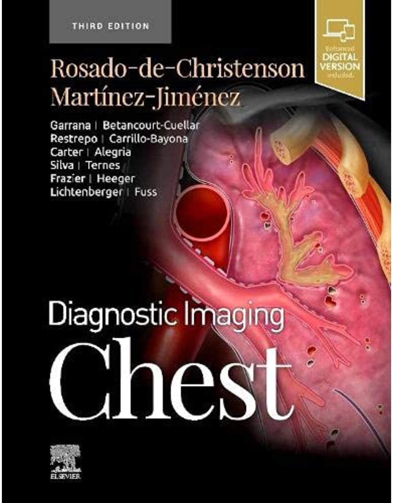 Diagnostic Imaging: Chest