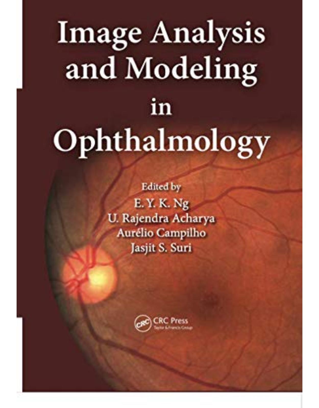 Image Analysis and Modeling in Ophthalmology