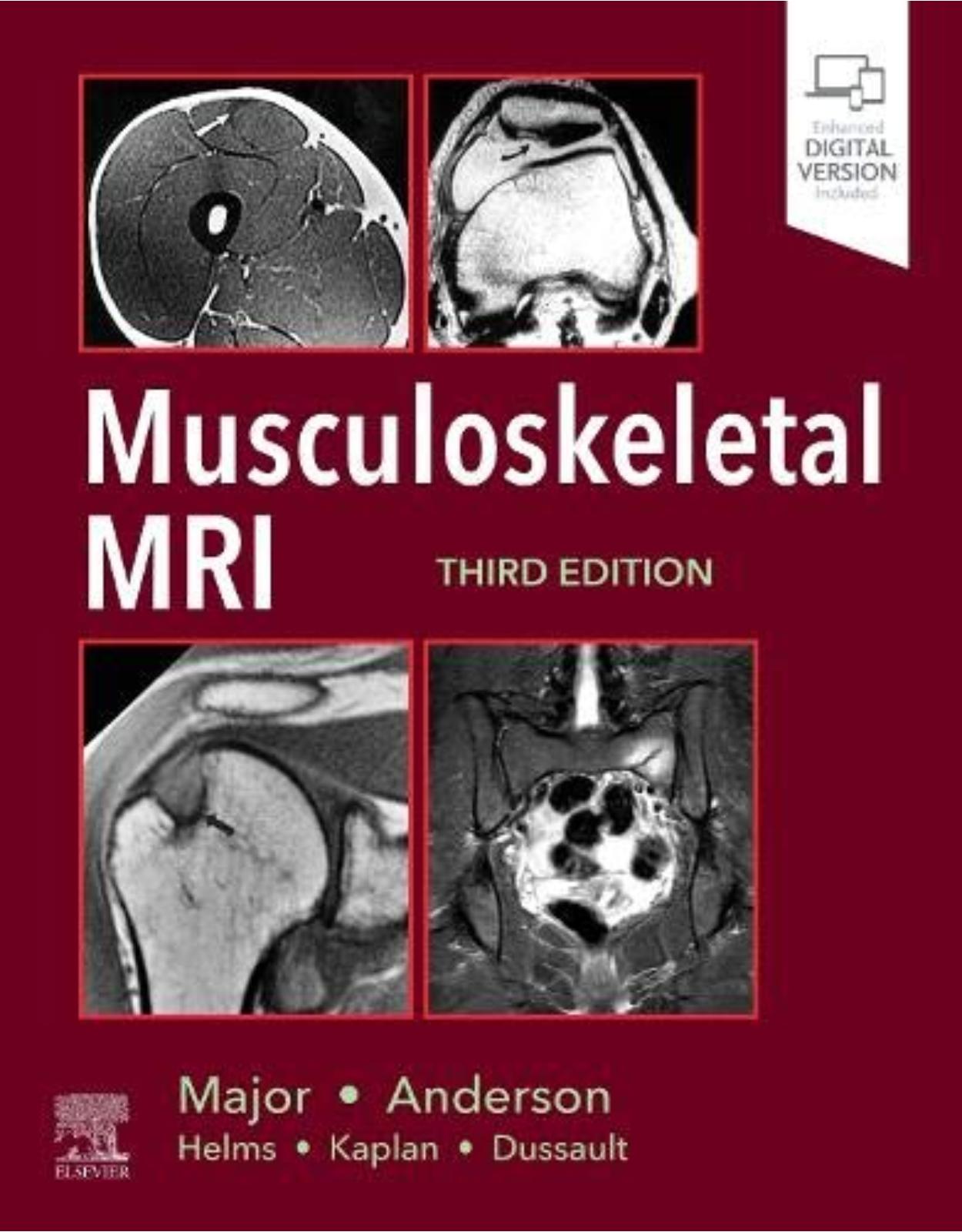 Musculoskeletal MRI, 3rd Edition