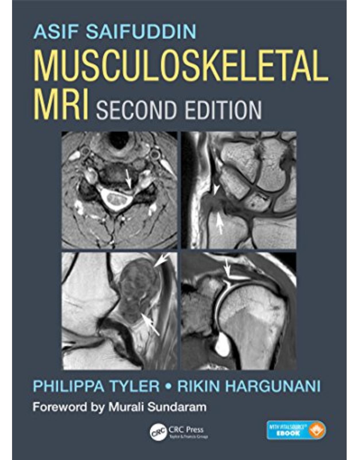 Musculoskeletal MRI