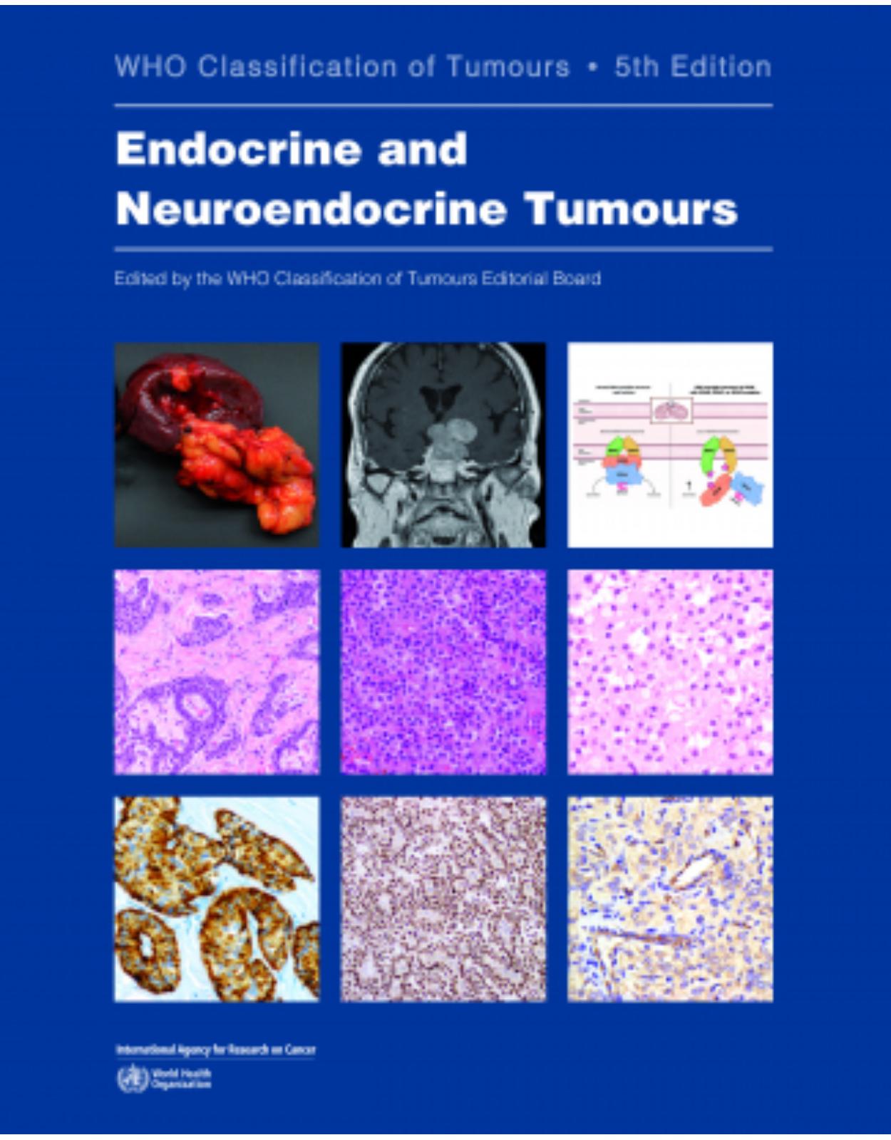 WHO Classification of Endocrine and Neuroendocrine Tumours, 5th edition - WHO Classification of Tumours, Volume 10