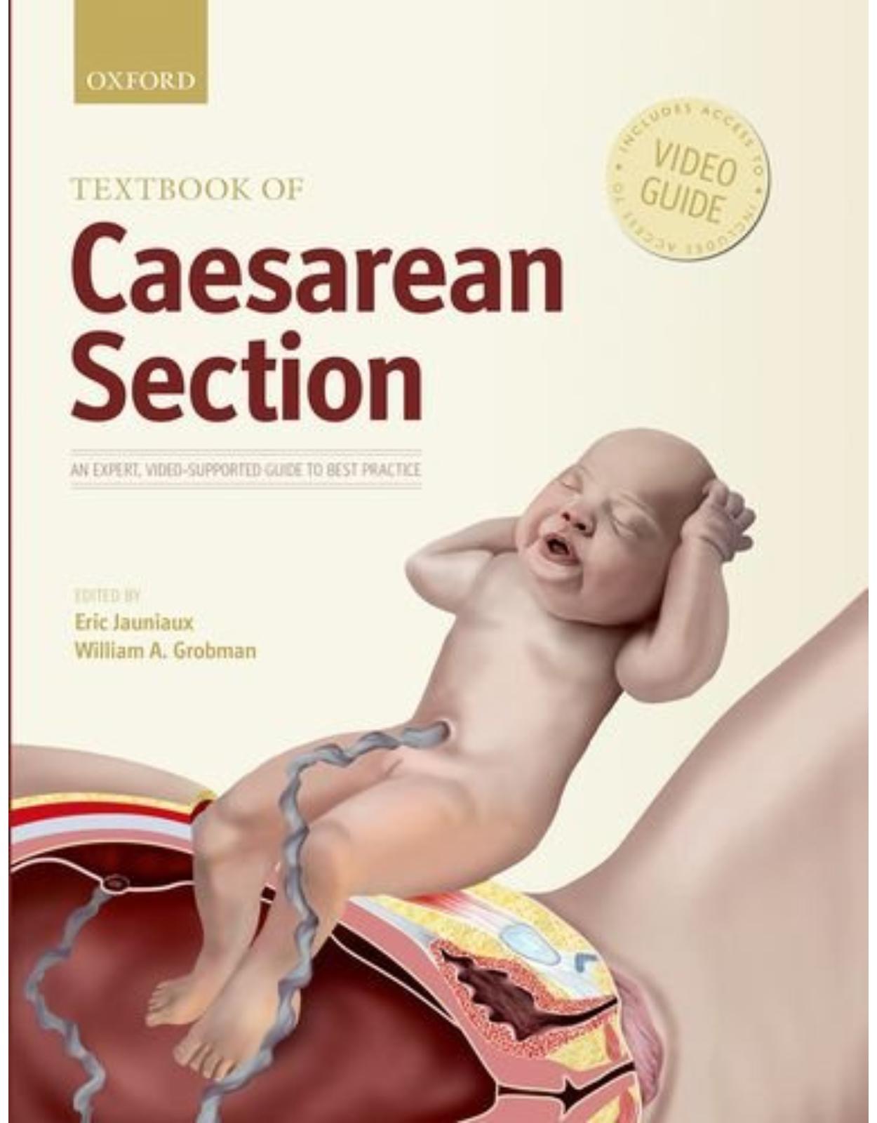 Textbook of Caesarean Section