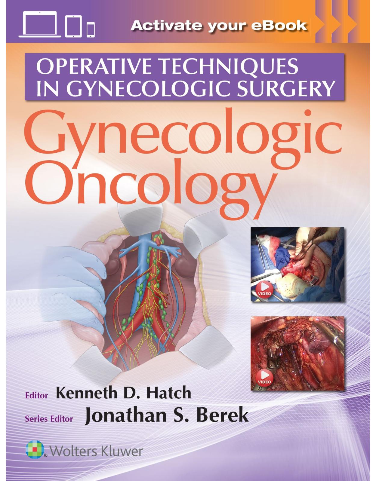 Operative Techniques in Gynecologic Surgery: Gynecologic Oncology