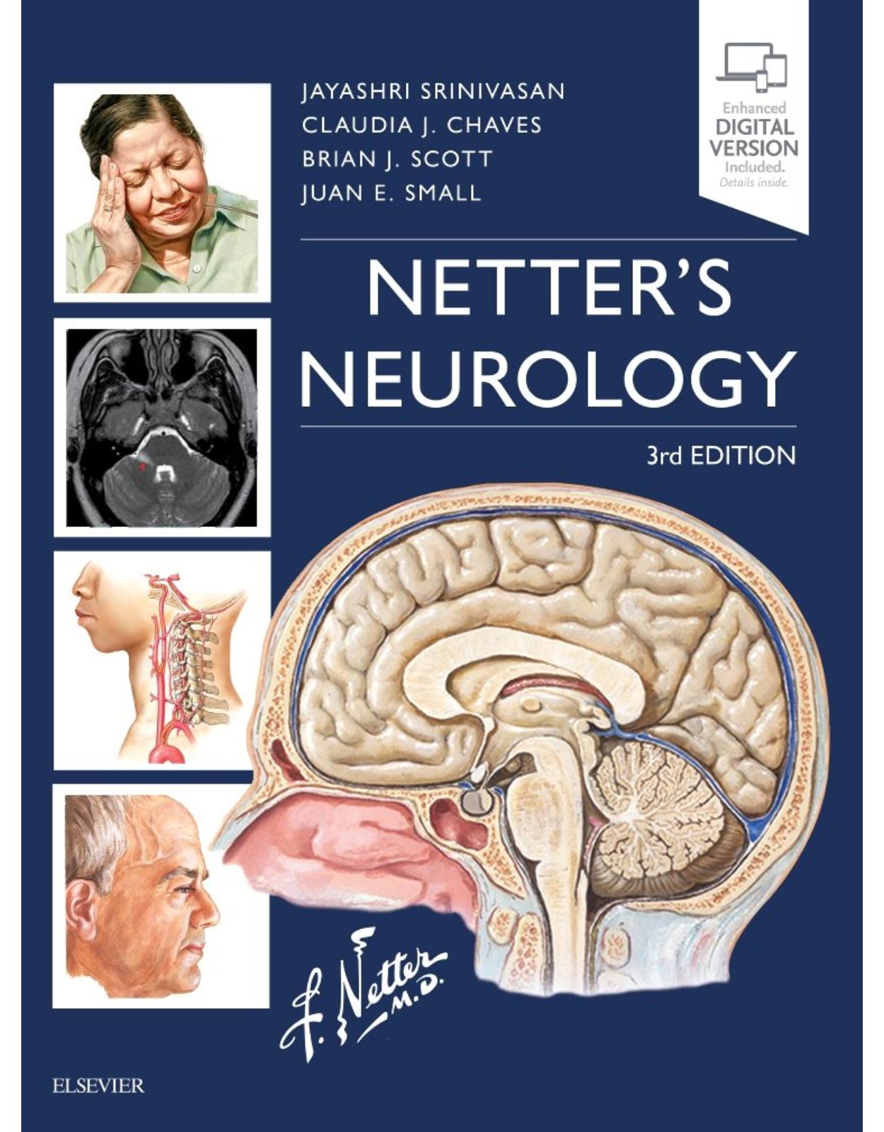Netter's Neurology, 3rd Edition