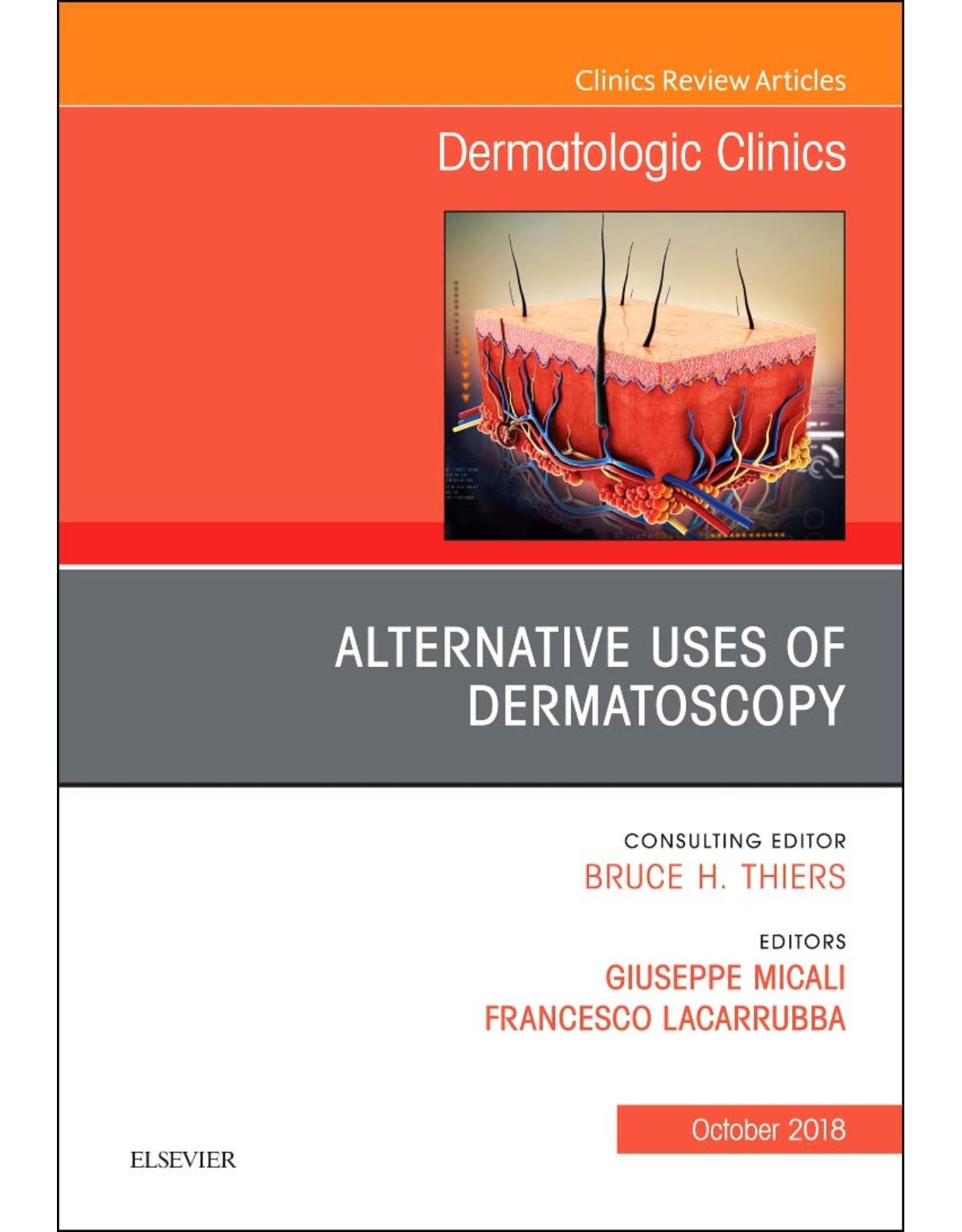 Alternative Uses of Dermatoscopy, An Issue of Dermatologic Clinics, Volume 36-4
