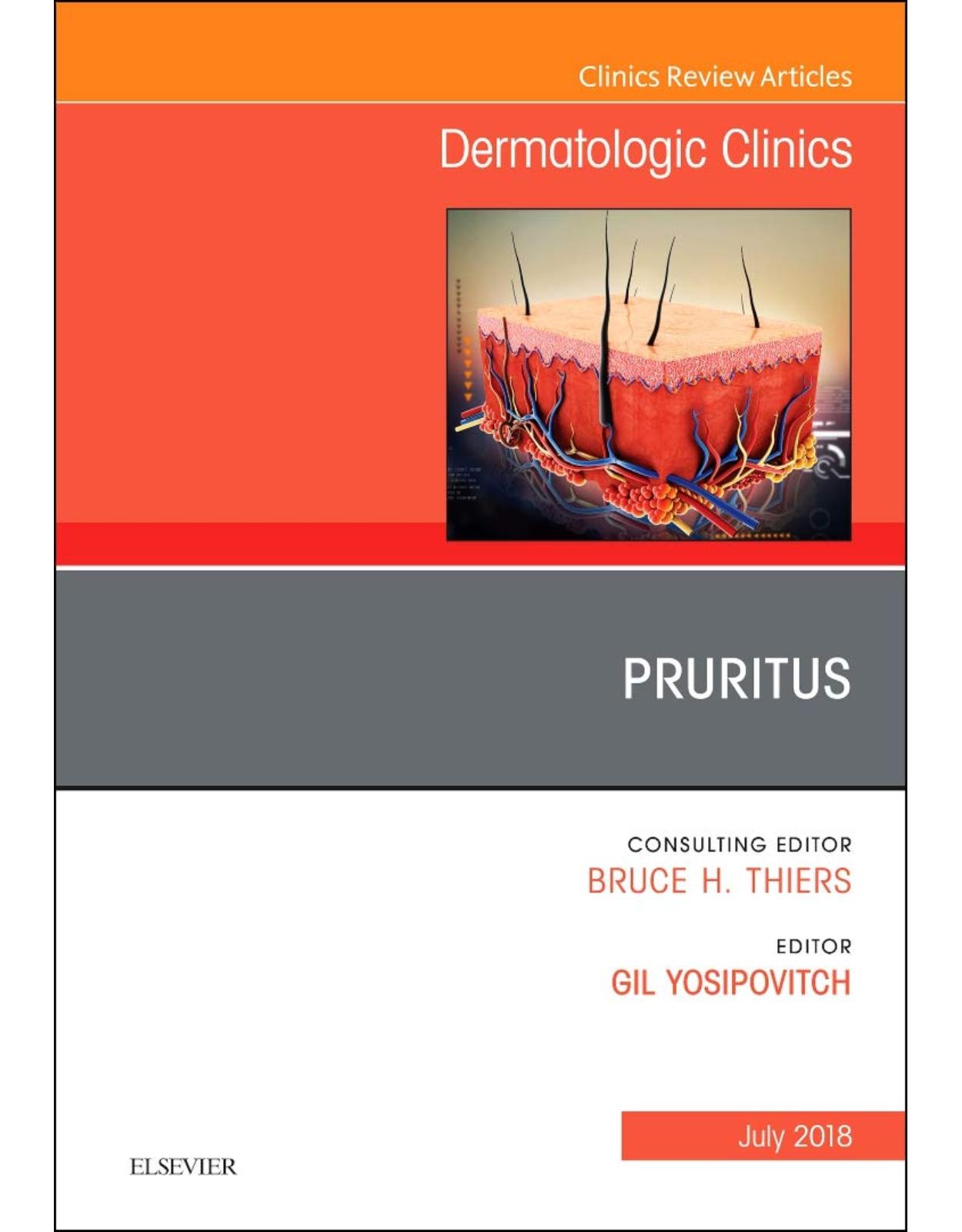 Pruritus, An Issue of Dermatologic Clinics, Volume 36-3