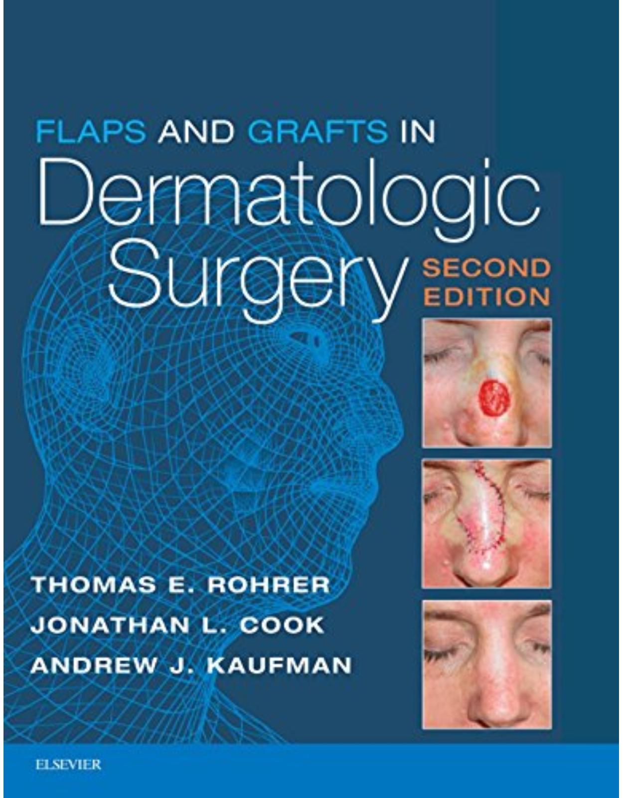 Flaps and Grafts in Dermatologic Surgery, 2nd Edition