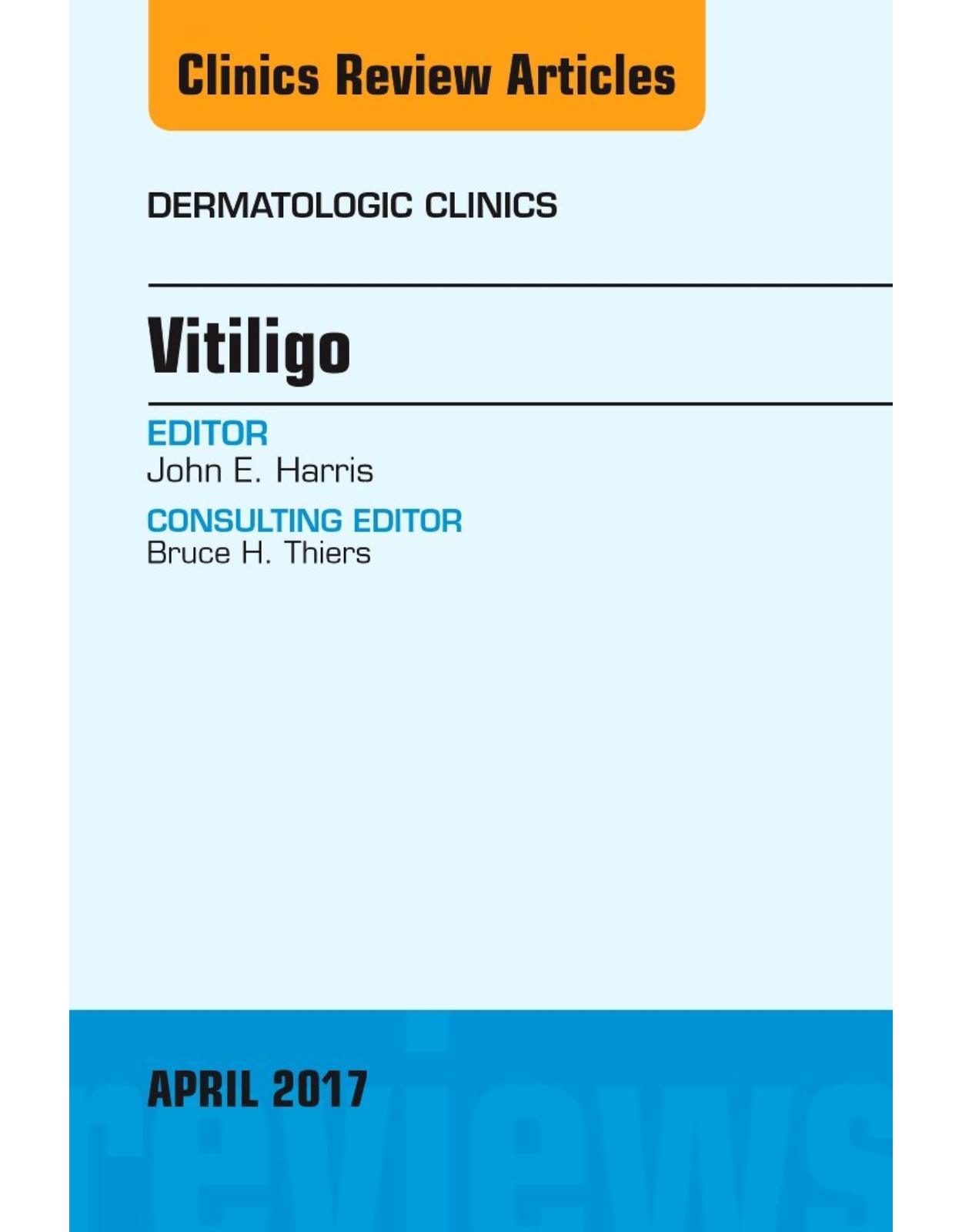 Vitiligo, An Issue of Dermatologic Clinics, Volume 35-2