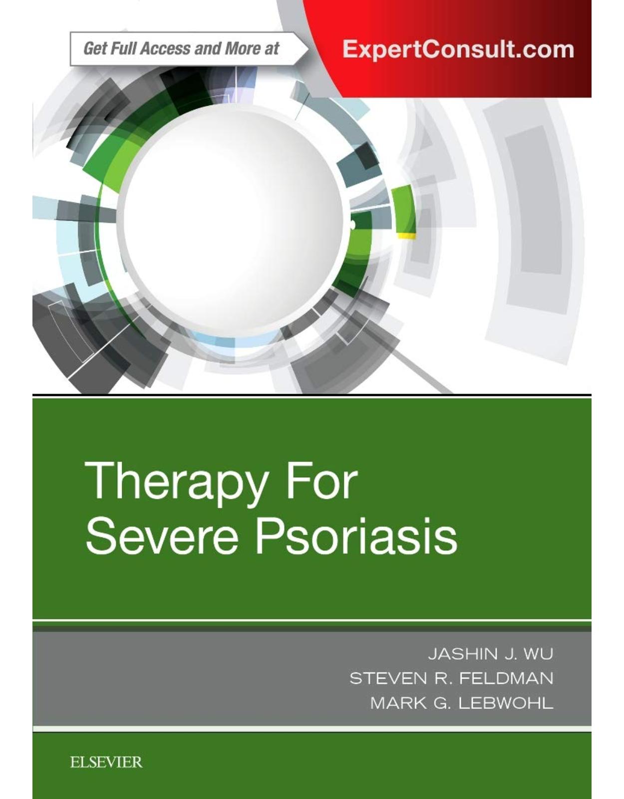 Therapy for Severe Psoriasis