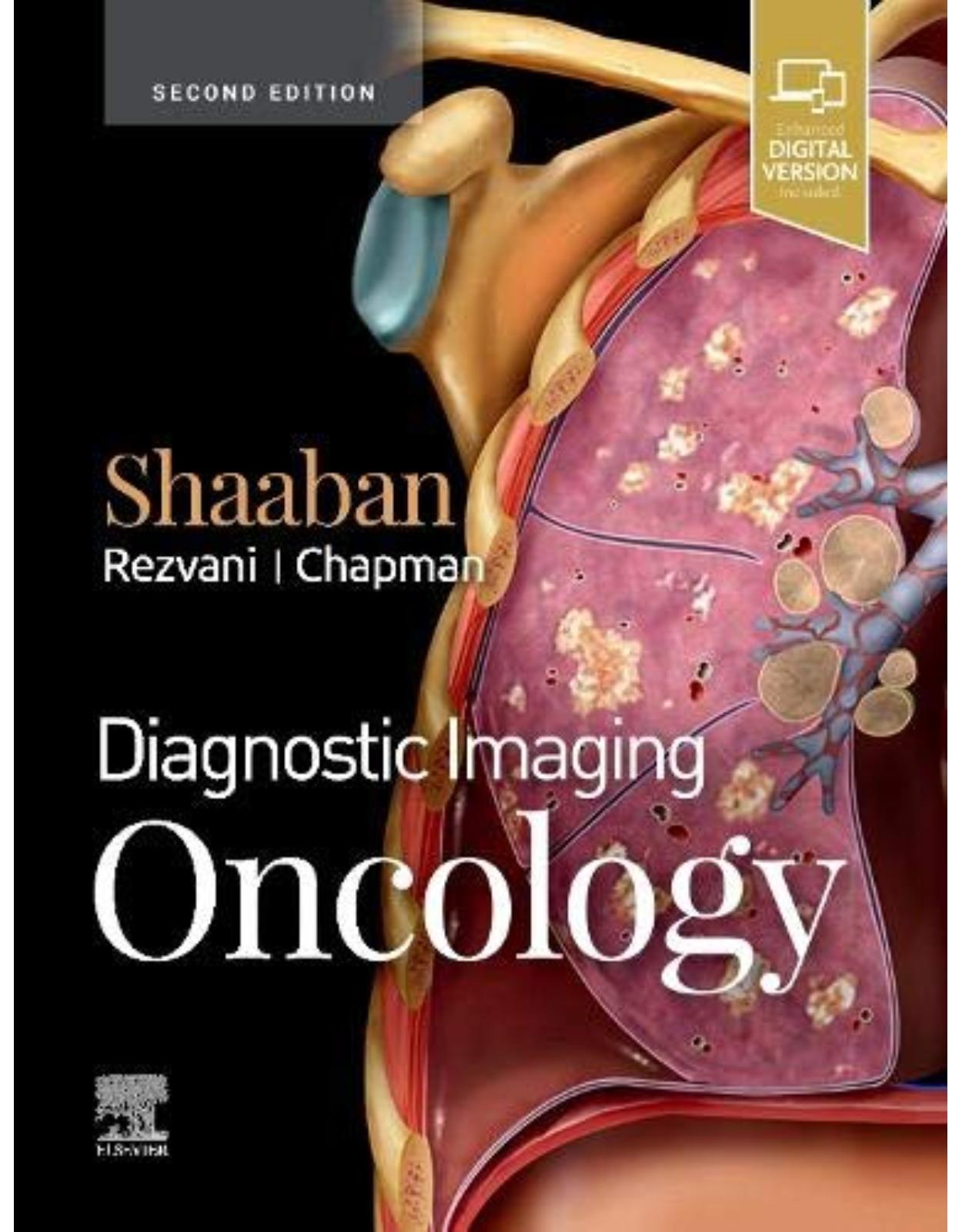 Diagnostic Imaging: Oncology, 2nd Edition